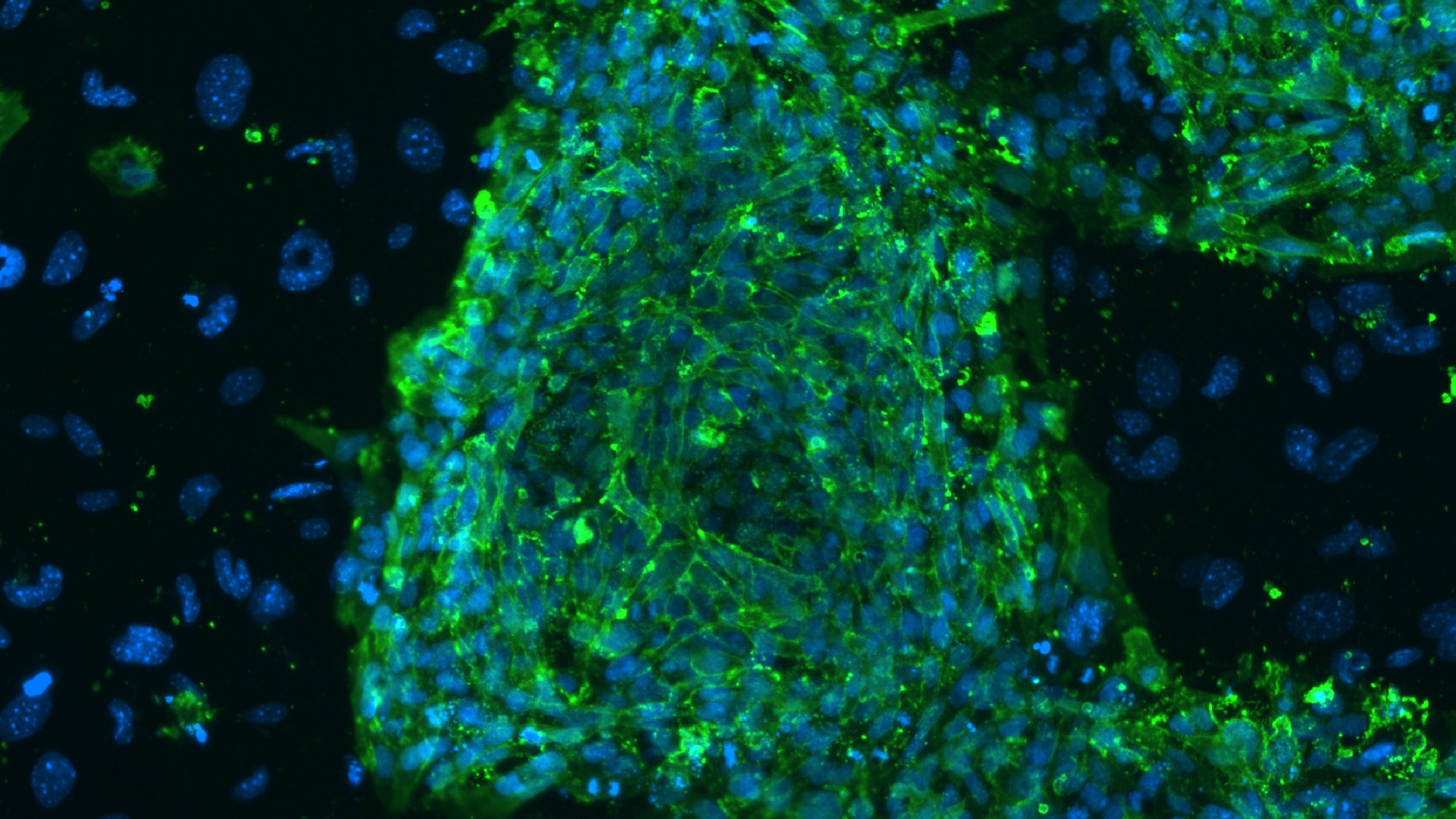 A fluorescent microscope image shows human embryonic stem cells in this photo taken at Stanford University and released by the California Institute for Regenerative Medicine.