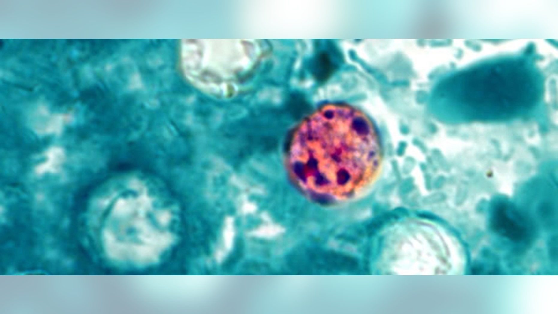 In this image provided by the Centers for Disease Control and Prevention, a photomicrograph of a fresh stool sample, which had been prepared using a 10% formalin solution, and stained with modified acid-fast stain, reveals the presence of four Cyclospora cayetanensis oocysts in the field of view. Iowa and Nebraska health officials said Tuesday, July 30, 2013, that a prepackaged salad mix is the source of a cyclospora outbreak that sickened more than 178 people in both states. Cyclospora is a rare parasite that causes a lengthy gastrointestinal illness. (AP Photo/Centerd for Disease Control and Prevention)