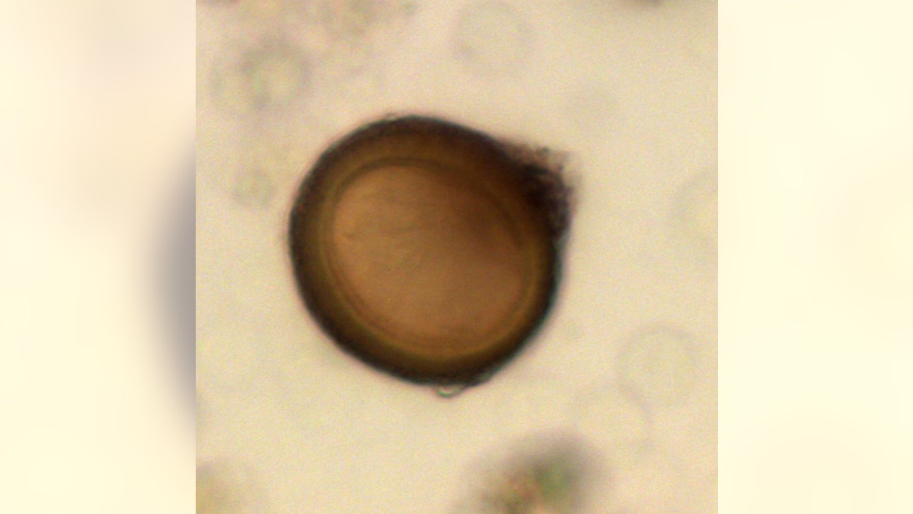 Two of the stools had low numbers of tapeworm eggs (Taenia), which have a round shape, thick walls with striations and a brown color.