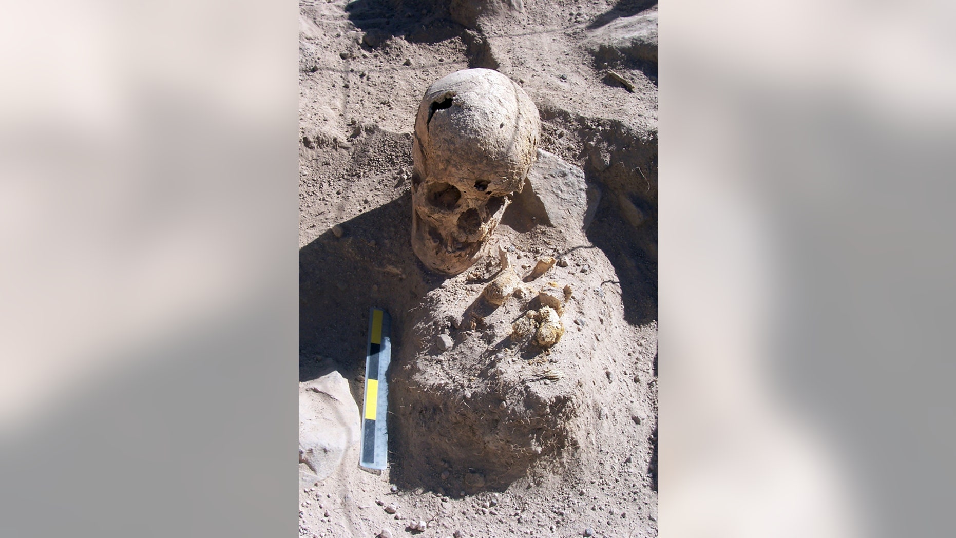 A burial of a young woman found in the middle of a tomb. Analysis of her skeletal remains reveal that she suffered dental problems, including tooth loss. At one point in her life she suffered an internal hemorrhage in the meninges of her cranium.