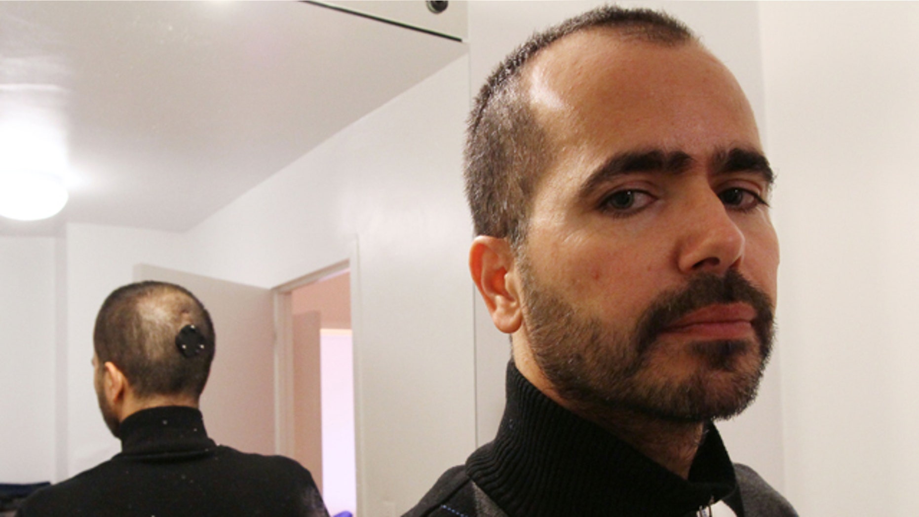 With the back of his head reflected in a mirror, artist Wafaa Bilal poses for a photograph Thursday, Dec. 2, 2010 in New York. Bilal had a mount for a camera surgically implanted into the back of his head for his art project "The 3rd I".