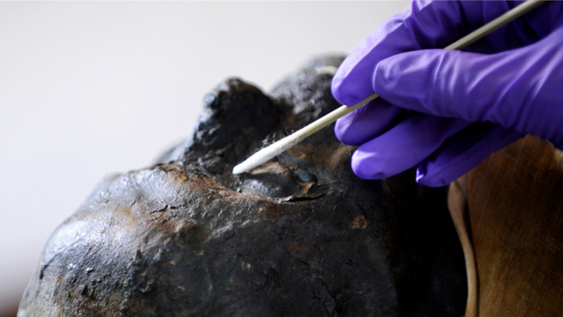 June 7, 2013: Mimi Leveque, a freelance conservator, cleans Padihershef, a 2,500-year-old Egyptian mummy at Mass General Hospital in Boston. Padihershef, who has made MGH his home since 1823, was a 40-year old stonecutter in the necropolis in Thebes, an ancient city on the west bank of the Nile.