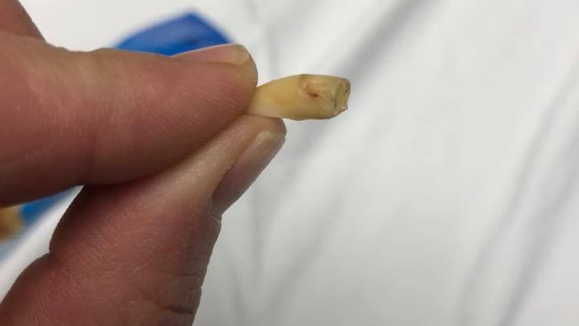 An Ohio woman claims she found a human tooth with dried blood on it in her package of Planters cashews.