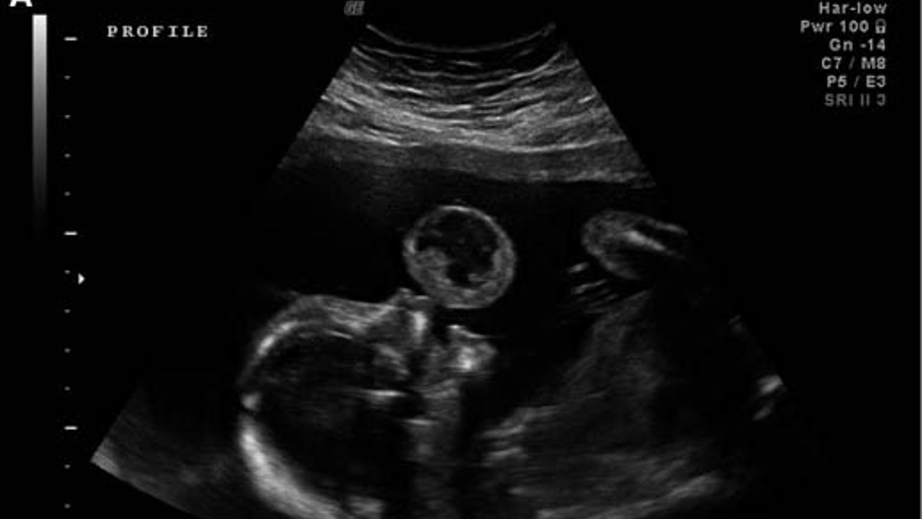 American Journal of Obstetrics & Gynecology