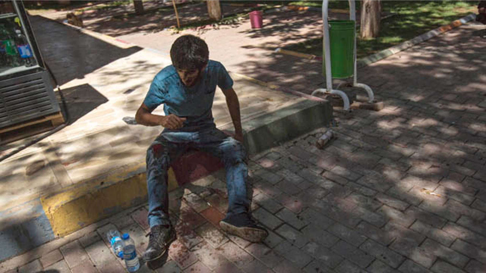 July 20, 2015: A youth wounded in an explosion that killed dozens of people and injured scores of others sits in the Turkish town of Suruc near the Syrian border (AP Photo/Zeki Yavuzak)