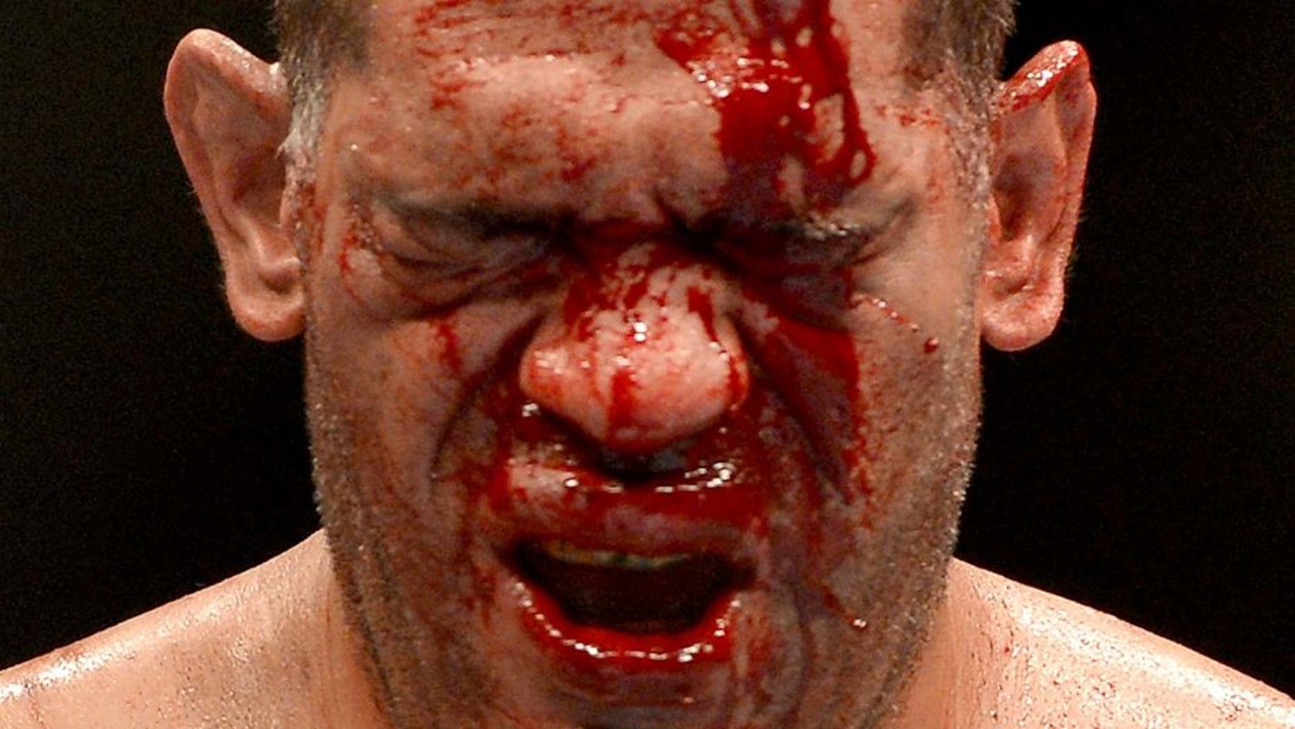 BRISBANE, AUSTRALIA - DECEMBER 07: Antonio 'Big Foot' Silva's face is full of blood during the UFC Brisbane bout between Mark Hunt and Antonio 'Big Foot' Silva of Brazil at the Brisbane Entertainment Centre on December 7, 2013 in Brisbane, Australia. (Photo by Bradley Kanaris/Getty Images)