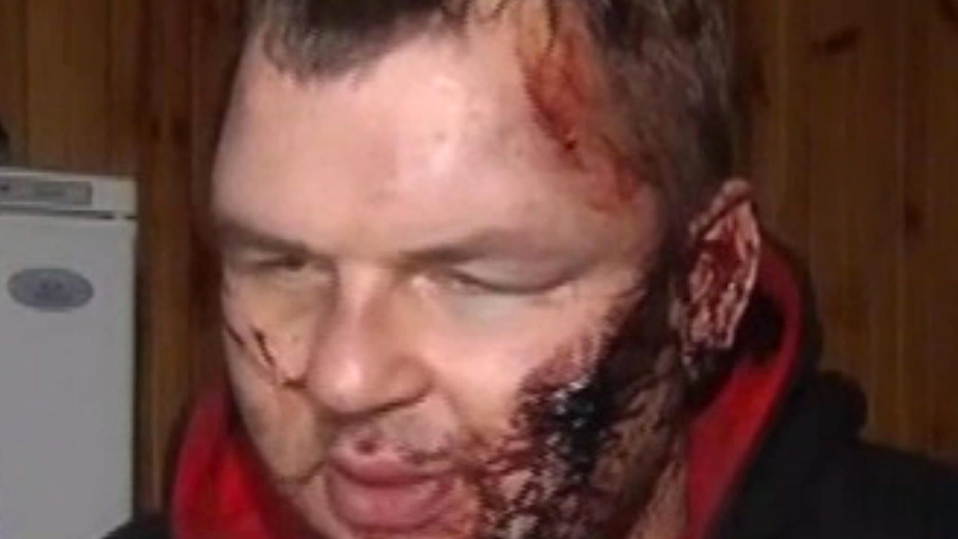 Jan. 31, 2014 - Bloody Dmytro Bulatov speaks to press after he was found near Kiev, Ukraine. Bulatov, an opposition protester who disappeared more than a week ago says he was kidnapped and tortured by unknown assailants, in a chilling development that is likely to further stoke anger against the embattled government of President Viktor Yanukovych. Dmytro Bulatov, is the latest in a string of disappearances and mysterious attacks on prominent opposition leaders, which left 1 activist dead and several badly beaten. (5 Channel)