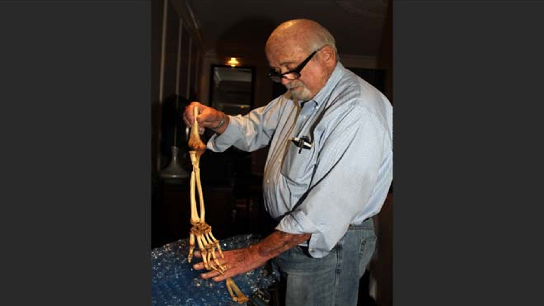 June 30, 2013: Dr. Sam Axelrad displays in a hotel room in Hanoi the bones of an arm he amputated in 1966 in the former South Vietnam. On Monday the Houston urologist was traveling to meet the amputee, Nguyen Quang Hung. Axelrad, 74, amputated Hung's infected arm in October 1966 in a U.S. military hospital after Hung was shot by American troops near Hung's hometown of An Khe. The two veterans were reunited after a Vietnamese journalist wrote an article last year about Axelrad's search for Hung, prompting Hung's brother to contact the newspaper.
