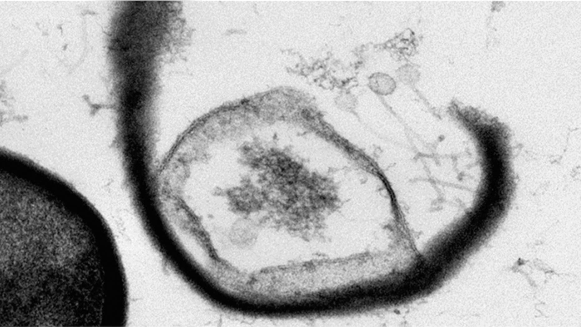 This image shows a burst open cell with phages escaping.