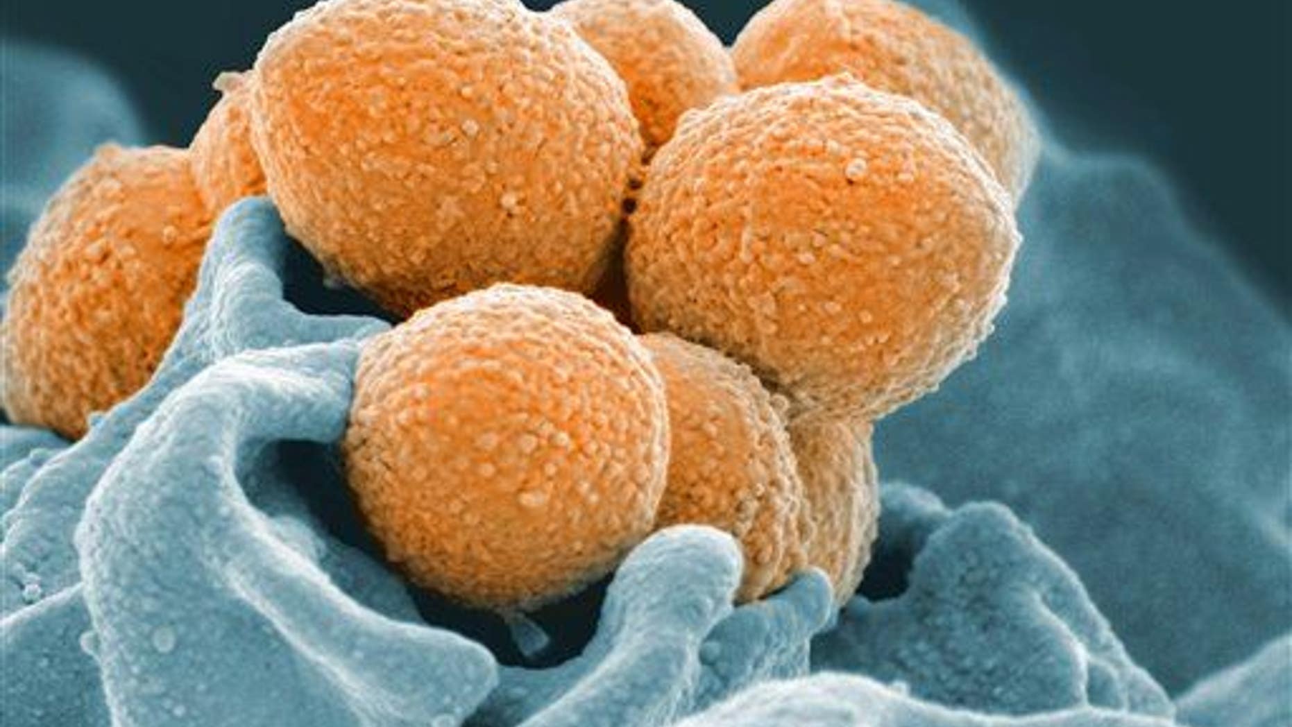 An electron microscope image of Group A Streptococcus (orange) during phagocytic interaction with a human neutrophil (blue).