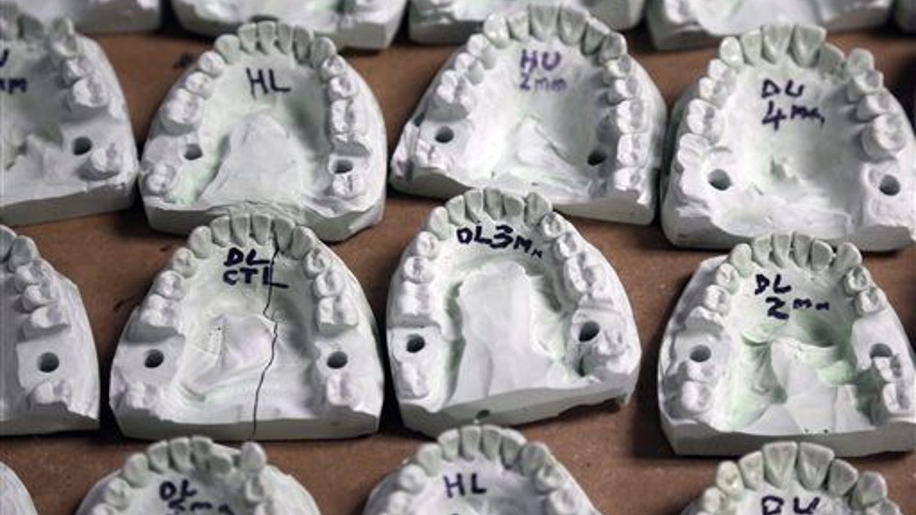 This April 17, 2013 file photo shows dental molds.