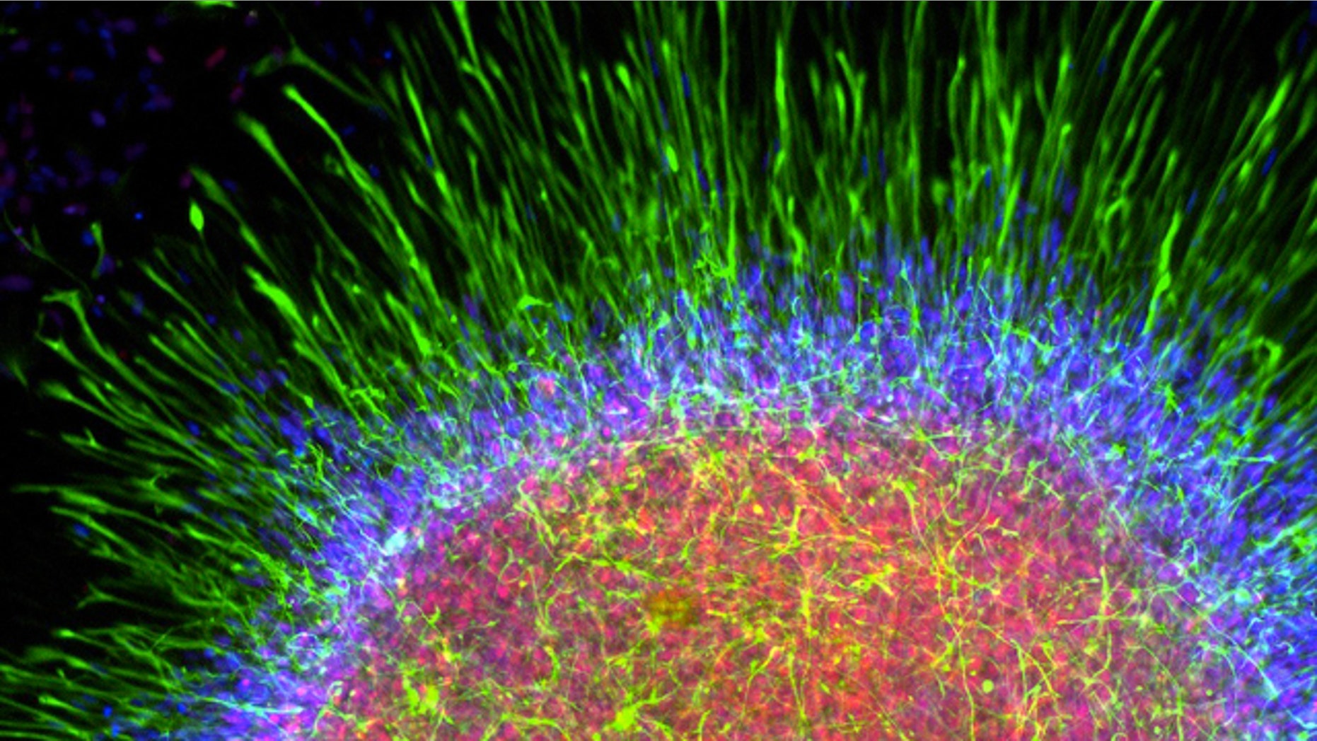 Astrocytes are star-shaped cells that are the most common cell in the human brain and have now been grown in the lab. In this picture astrocyte progenitors and immature astrocytes cluster to form an "astrosphere."