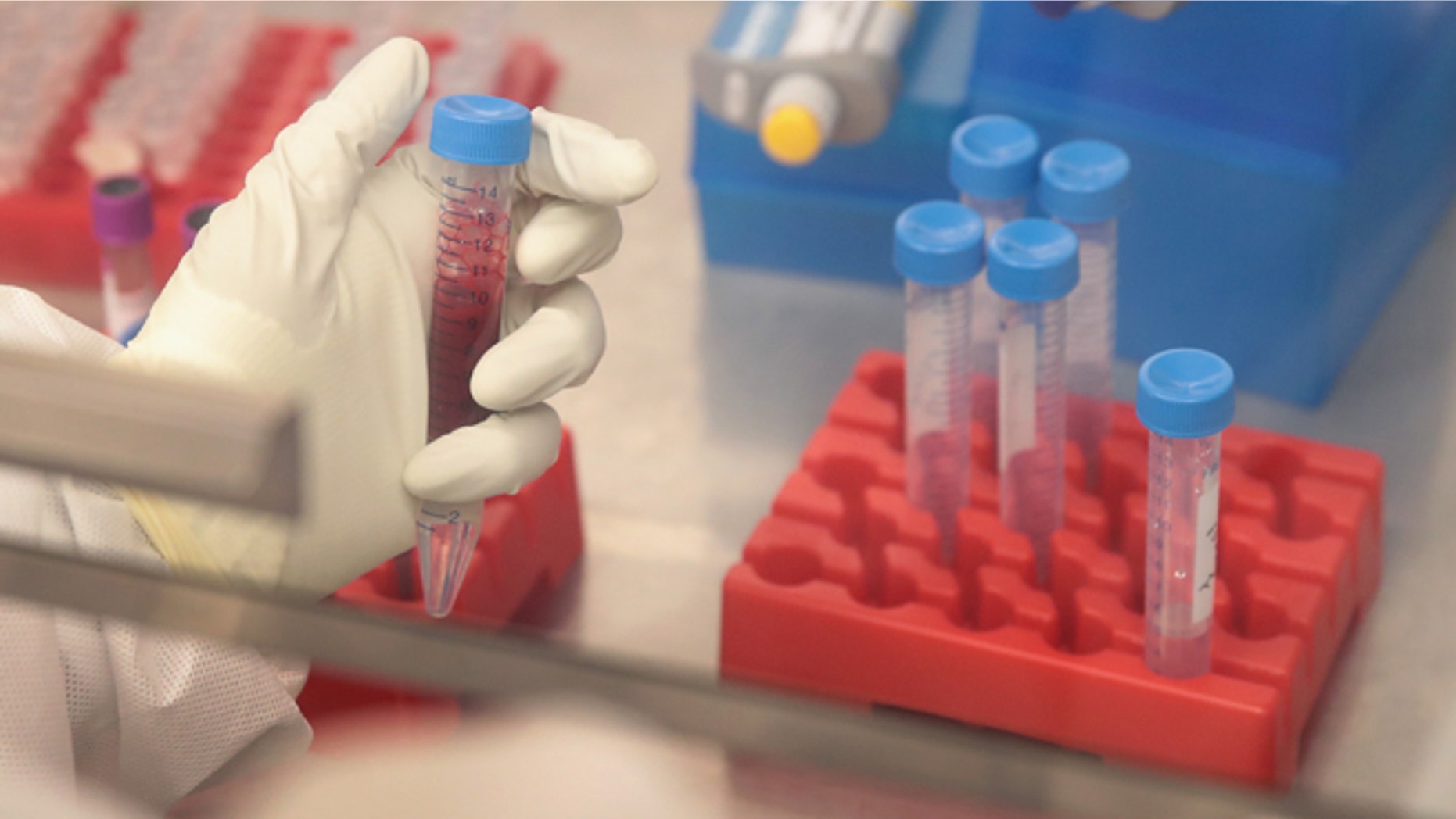 A researcher processes blood samples taken from pregnant rhesus macaque monkeys infected with the Zika virus on June 28, 2016. (Photo by Scott Olson/Getty Images)