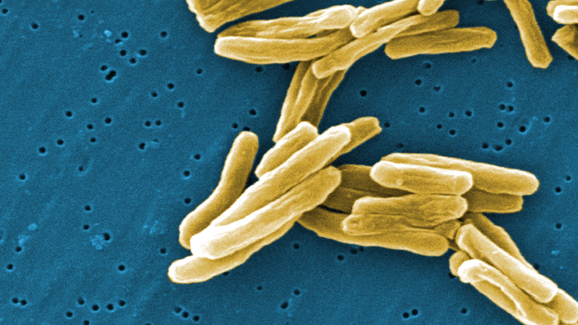This scanning electron micrograph (SEM) depicts some of the ultrastructural details seen in the cell wall configuration of a number of Gram-positive Mycobacterium tuberculosis bacteria.