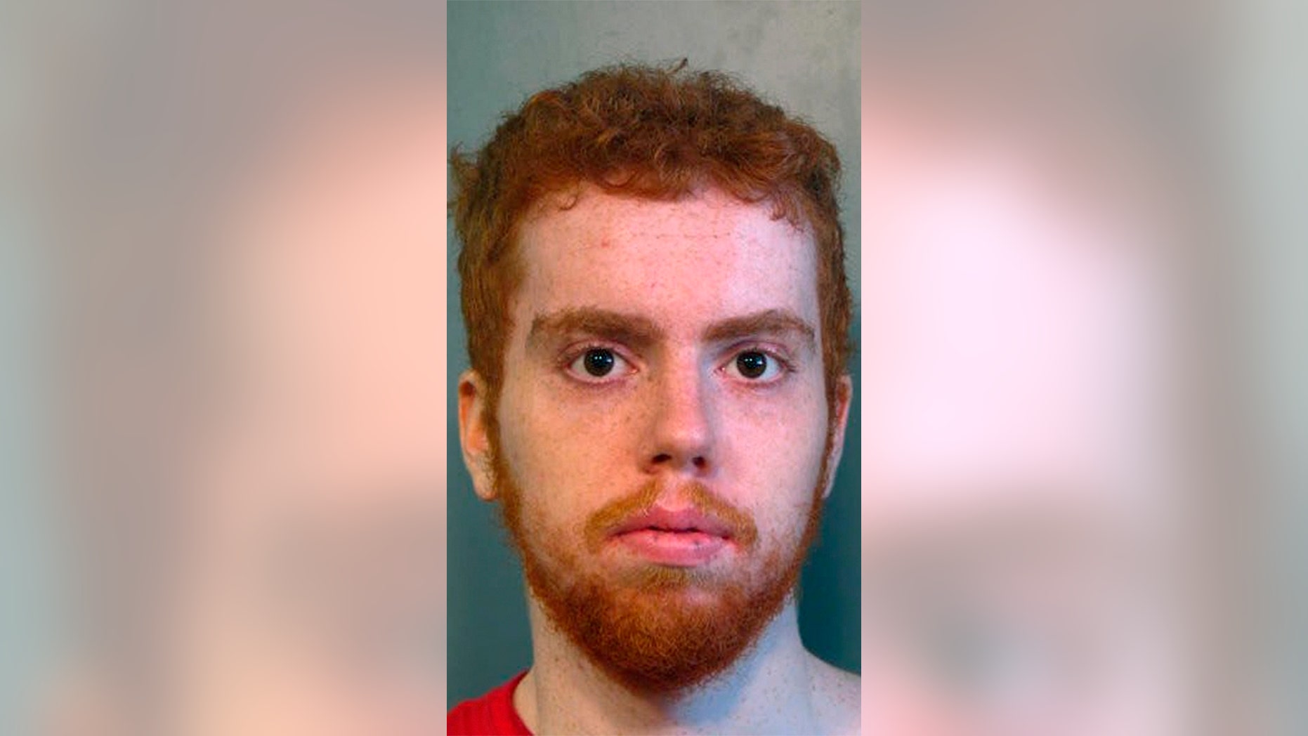Aaron Kluger was arrested Saturday for allegedly biting a dog's eye.