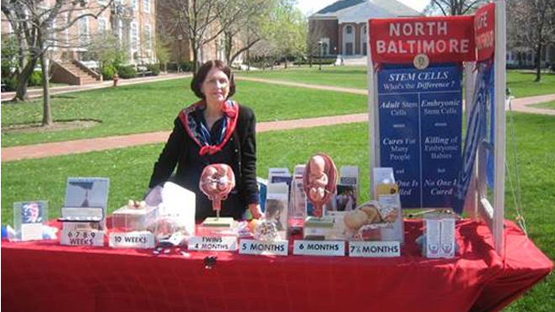 The display, which was initially rejected, shows the development of a fetus at various stages.