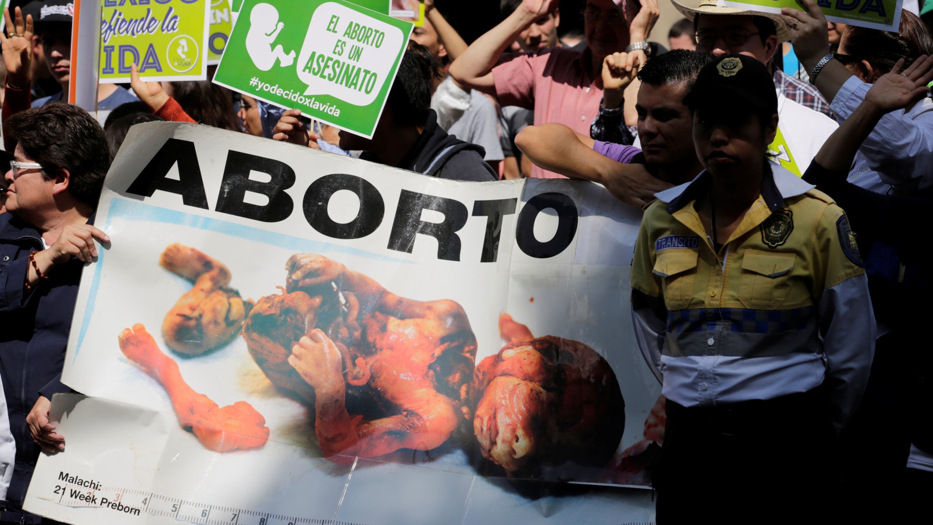 People and pro-life activists hold a banner with an image of a fetus which reads "Abortion."