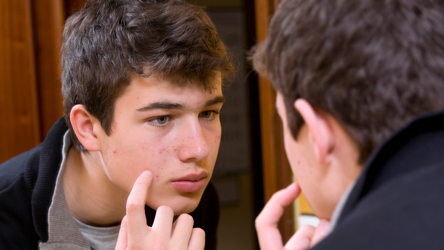 When dealing with this acne problem, teens may feel self-conscious and even hopeless because of their appearance.