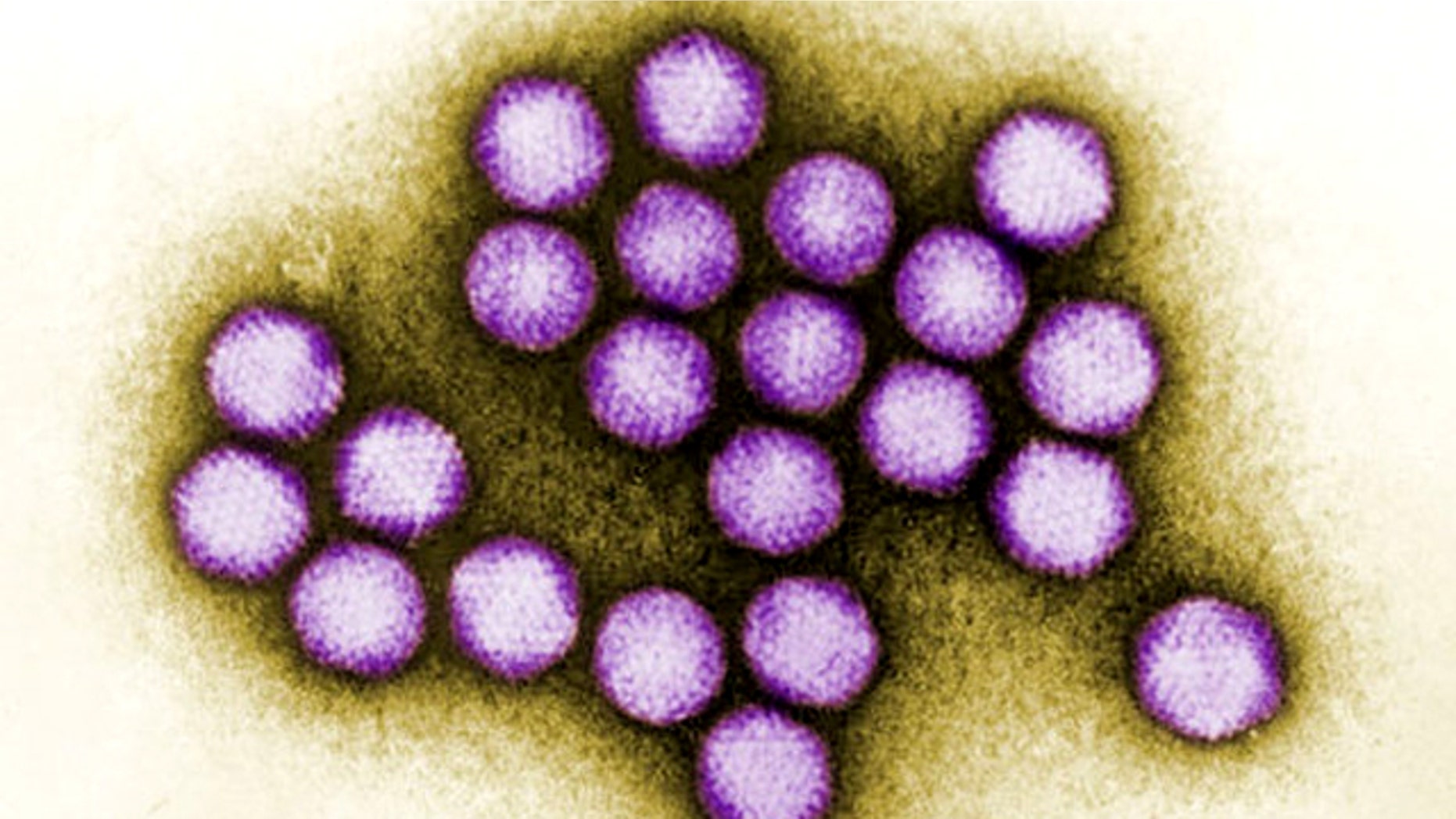An image of adenovirus, a type of virus known to cause respiratory infections, diarrhea and other problems, in humans, was among the many viruses, many of them previously unknown to turn up in samples of raw sewage.