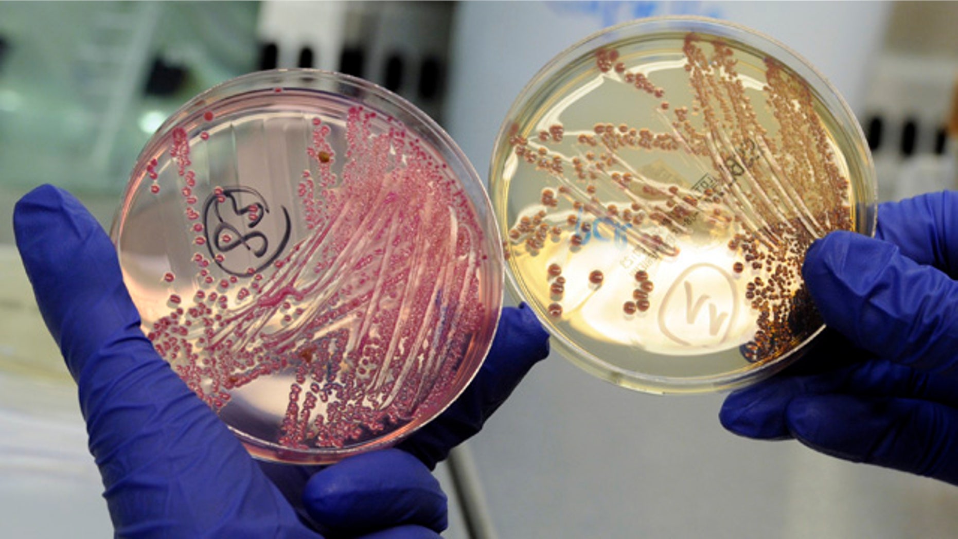 An employee holds petri dishes with bacterial strains of EHEC bacteria (bacterium Escherichia coli) in the microbiological laboratory of the Universitaetsklinikum Hamburg-Eppendorf (University Clinic Eppendorf- UKE) in the northern German town of Hamburg, June 2, 2011.