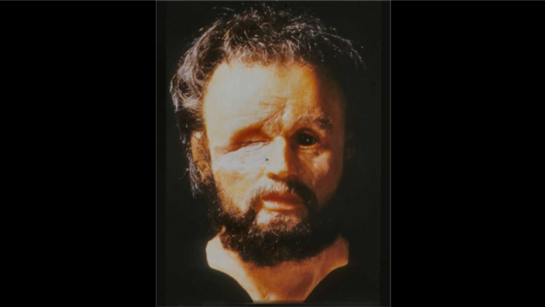 Facial reconstruction of the mystery skeleton done by medical illustrator Richard Neave, purporting to show Philip II with his famous eye wound.