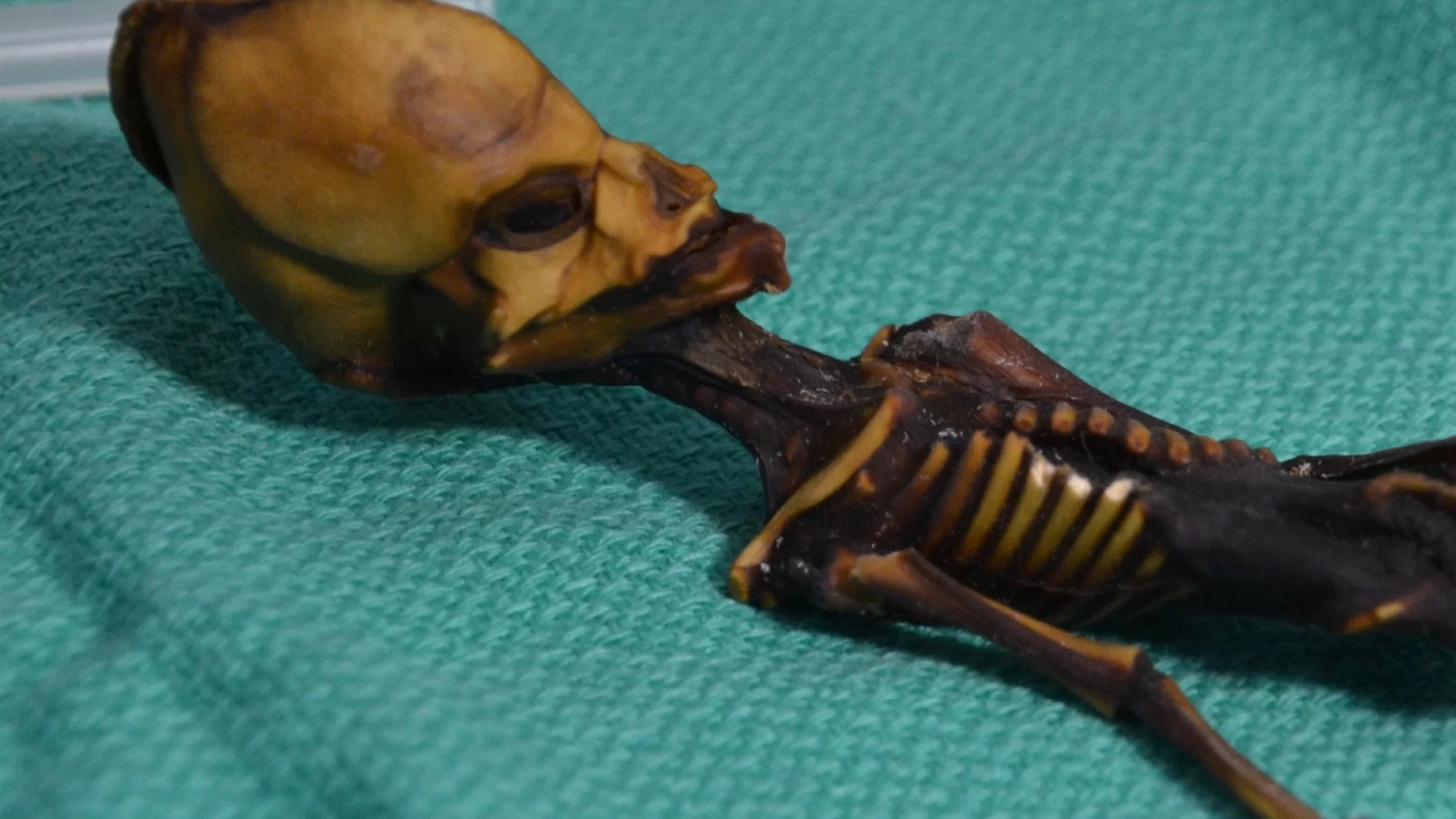 A mummified specimen from Chile's Atacama region fueled speculation for a decade about its peculiar skull. Credit: Bhattacharya S et al. 2018