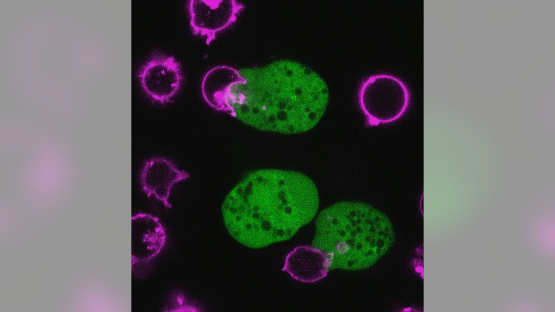 <em>Entamoeba histolytica</em> parasites ingesting bites of human cells. The cell membranes of the human cells were pre-labeled with DiD (pink) and the amoebae were pre-labeled with cell tracker green (green).