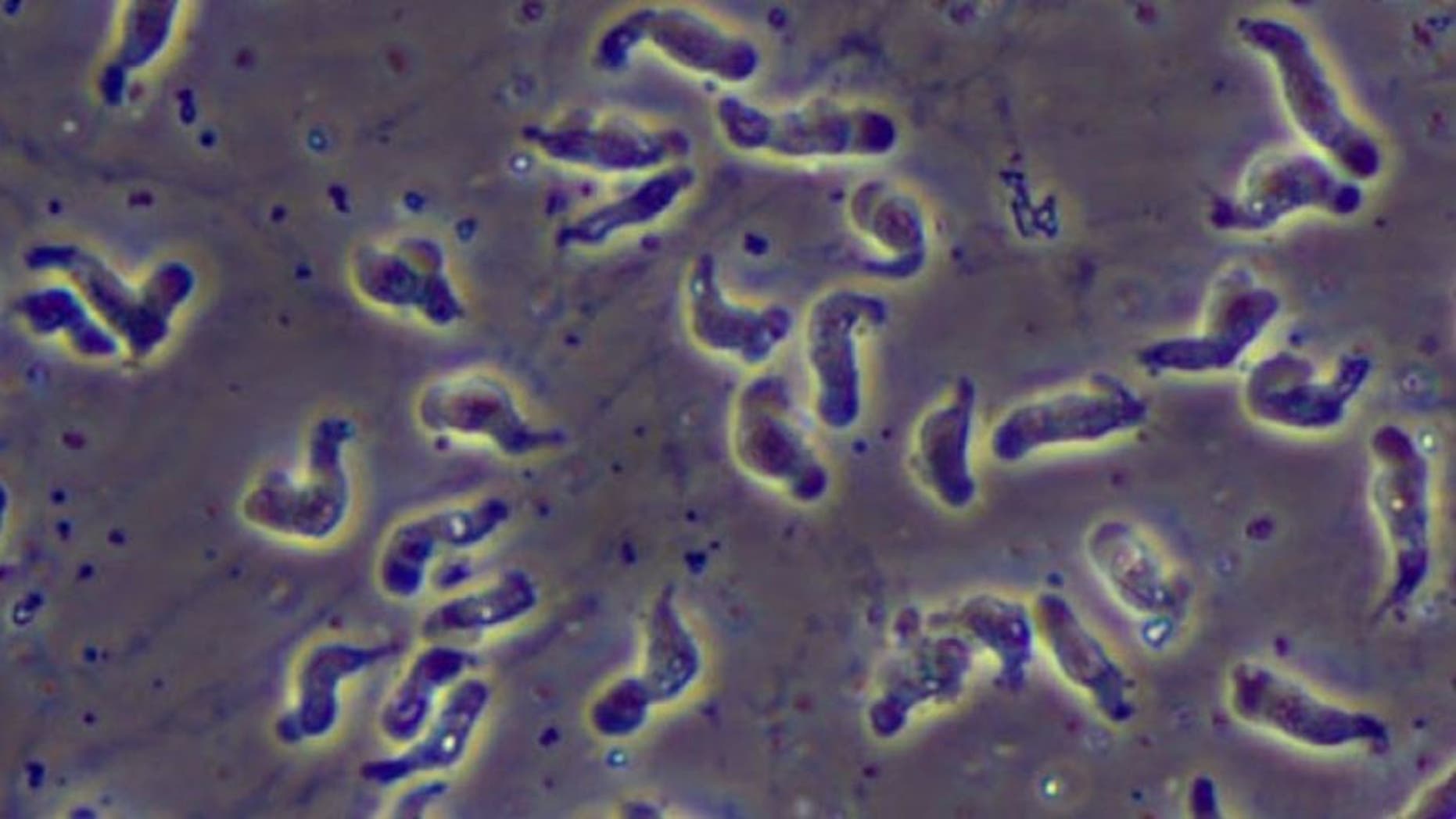 Naegleria fowleri, the brain-eating amoeba that causes primary amebic meningoencephalitis, can be caught in warm water locations.