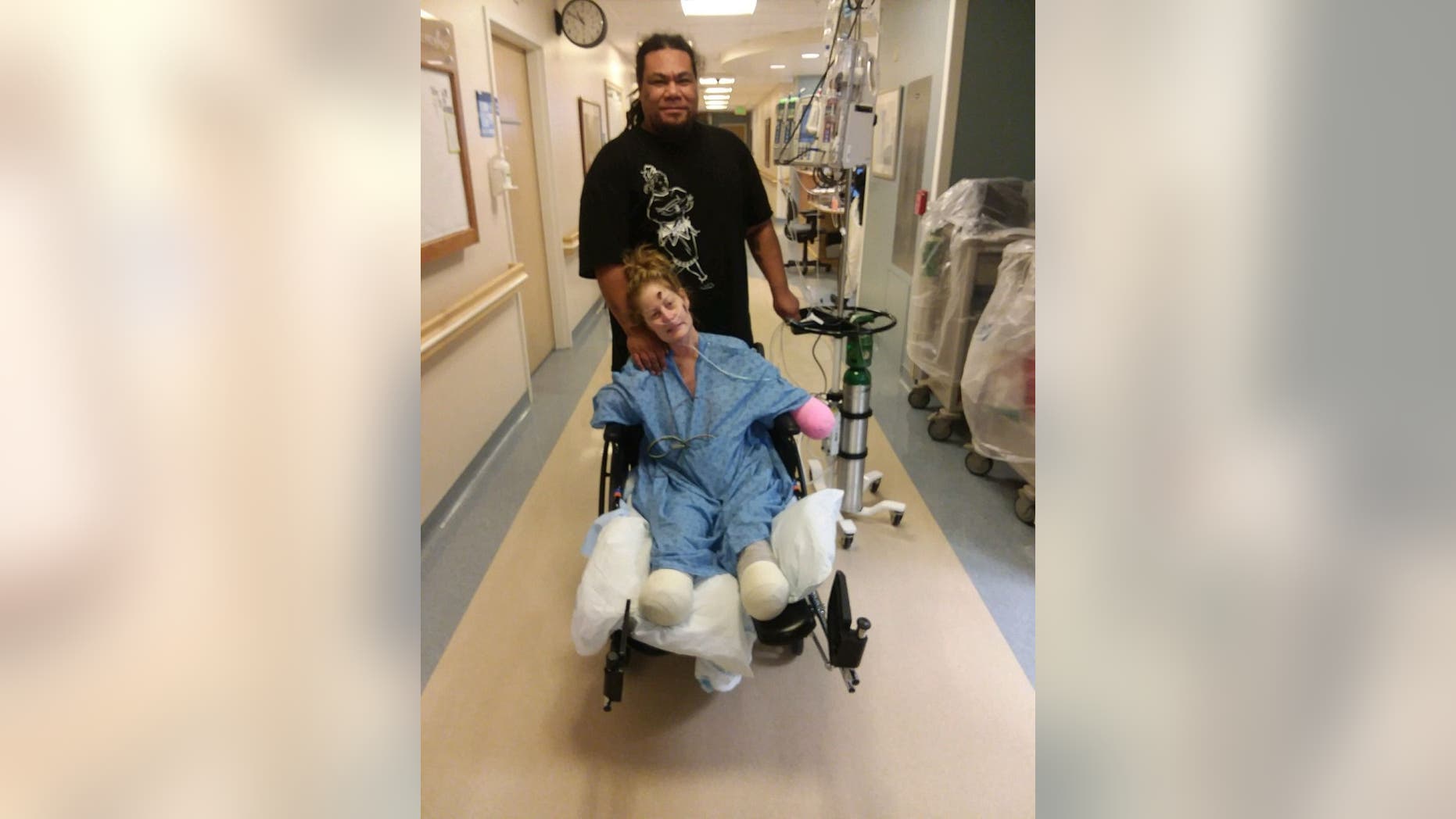 A Utah woman is in the hospital recovering after having both her arms and legs amputated.