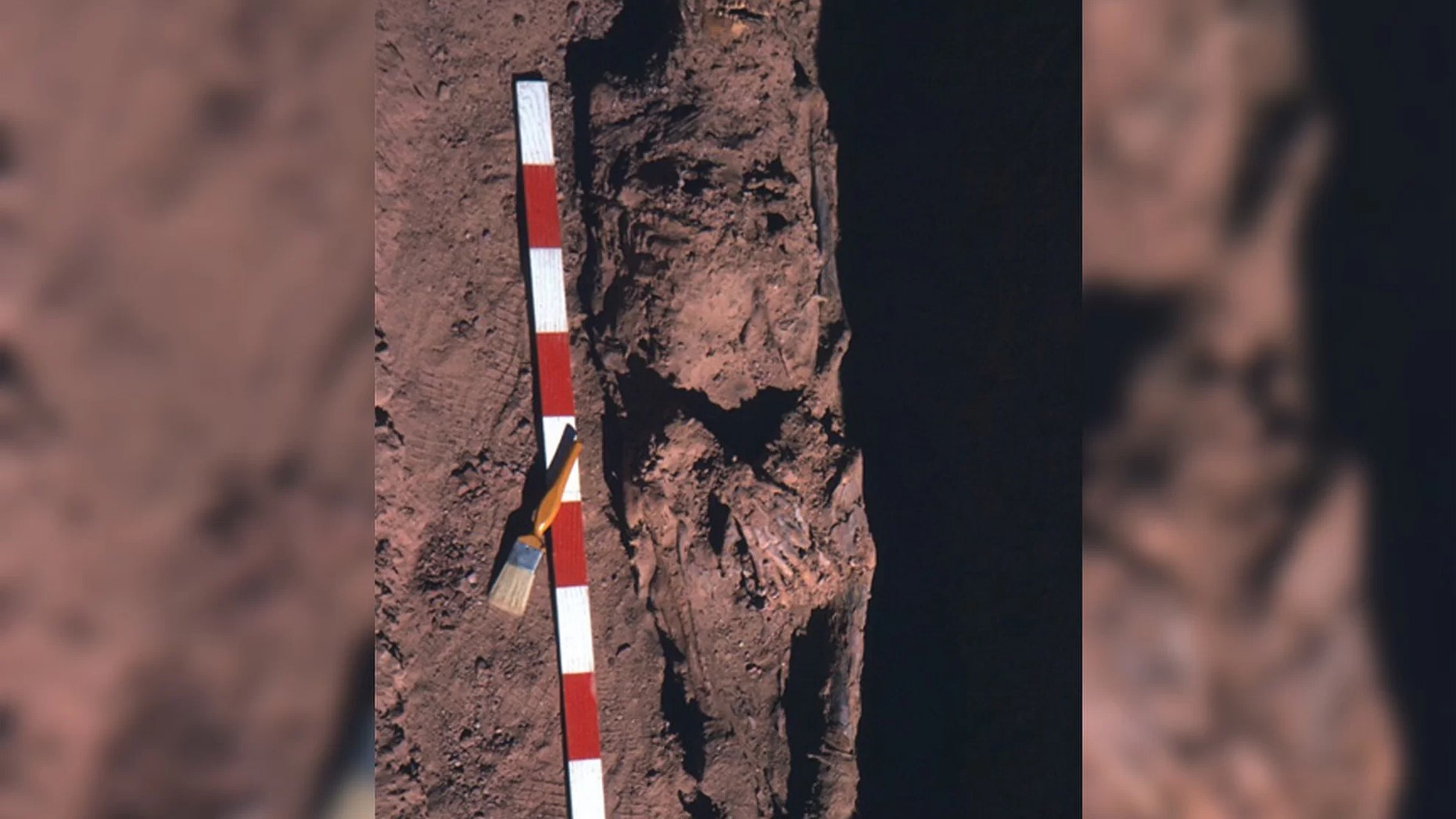 This image show the mummy of an ancient Egyptian man in his 50s who had rectal cancer. Credit: Image courtesy El Molto