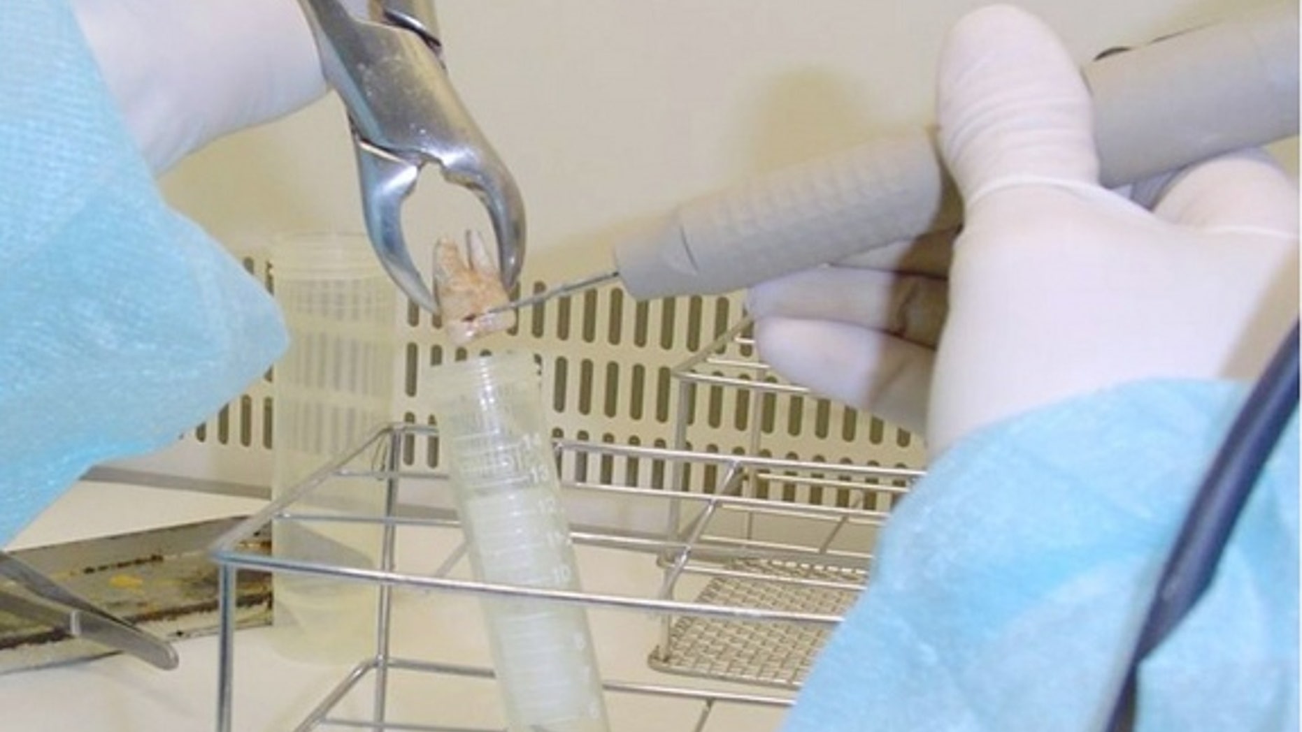 A researcher collects a sample from an ancient human tooth in search of the bacteria that cause cavities and tooth decay.