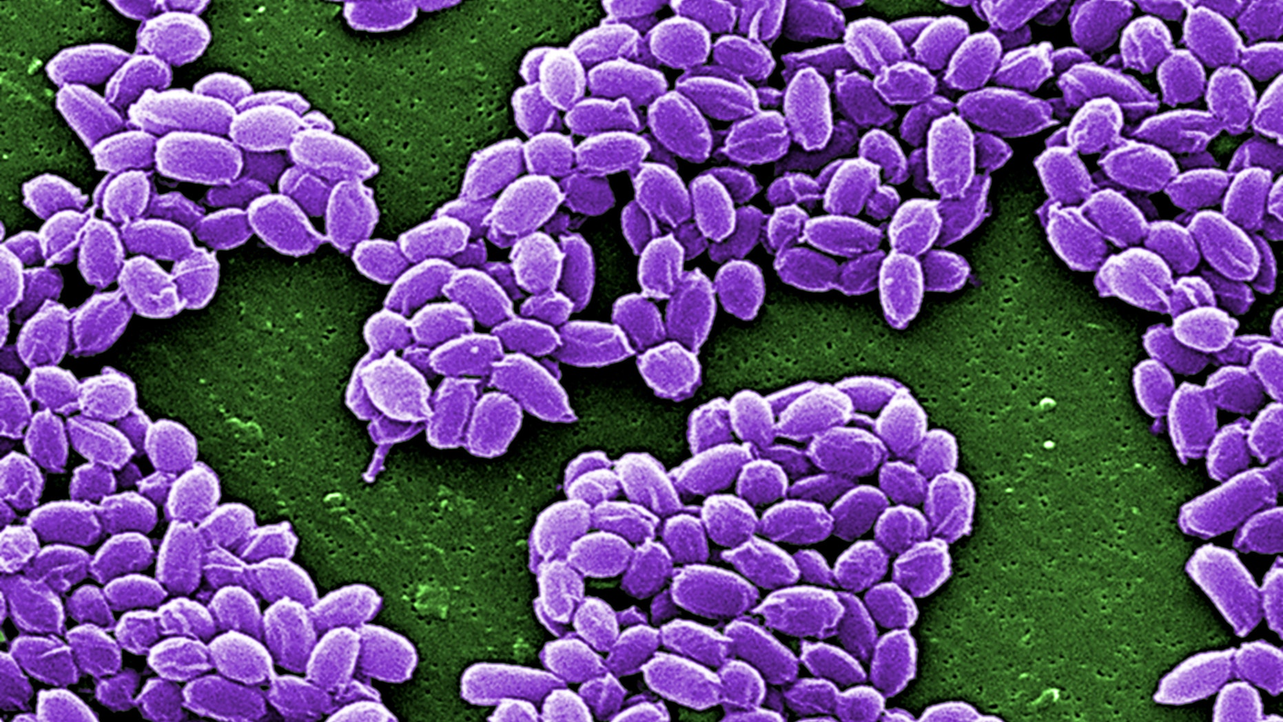File photo - Spores from the Sterne strain of anthrax bacteria (Bacillus anthracis) are pictured in this handout scanning electron micrograph (SEM) obtained by Reuters May 28, 2015. (REUTERS/Center for Disease Control/Handout via Reuters)