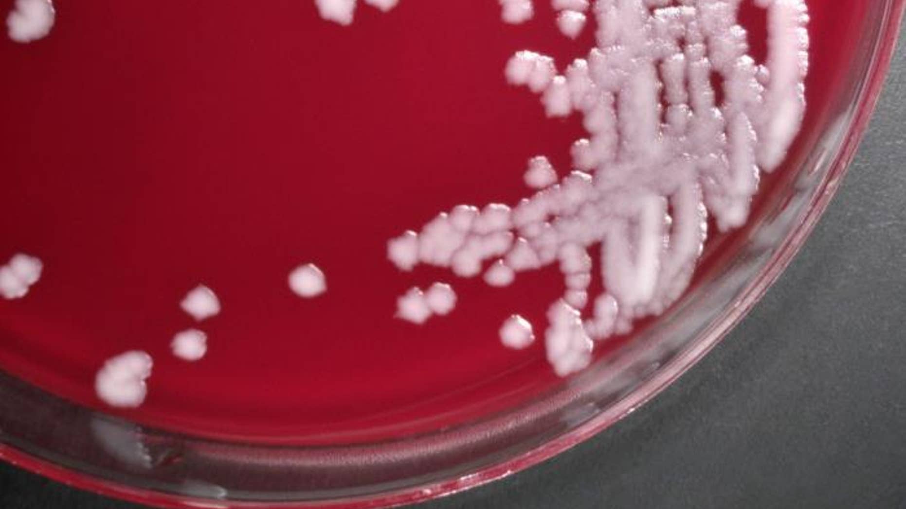 This photograph depicts the colonial growth displayed by Sterne strain members of the Gram-positive bacterium, Bacillus anthracis. Anthrax is a serious infectious disease caused by gram-positive, rod-shaped bacteria known as Bacillus anthracis. (CDC/ Dr. Todd Parker. Ph.D.; Assoc. Director for Lab. Science/DPEI(Acting) and LRN Training Coordinator)