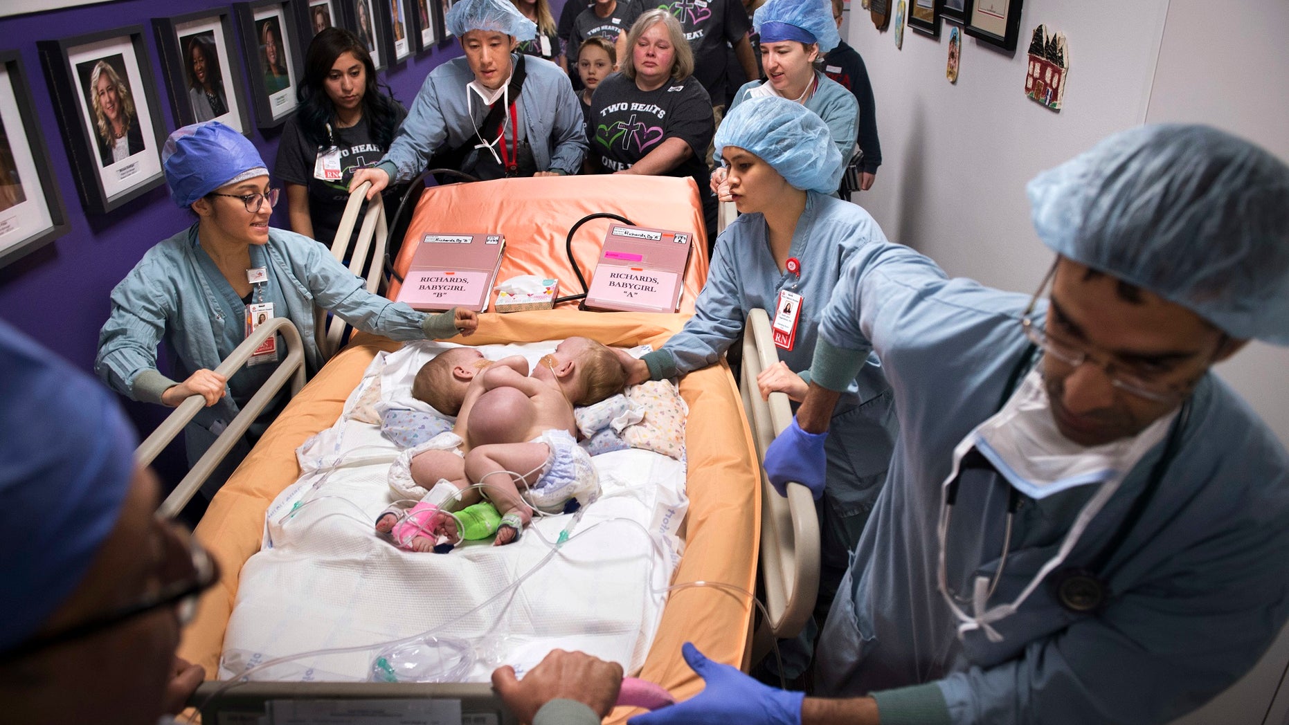 Hospital personnel wheel conjoined twins, Anna and Hope Richards, to surgery on Jan. 13. The girls who were born in 2016 were conjoined at the chest and abdomen.