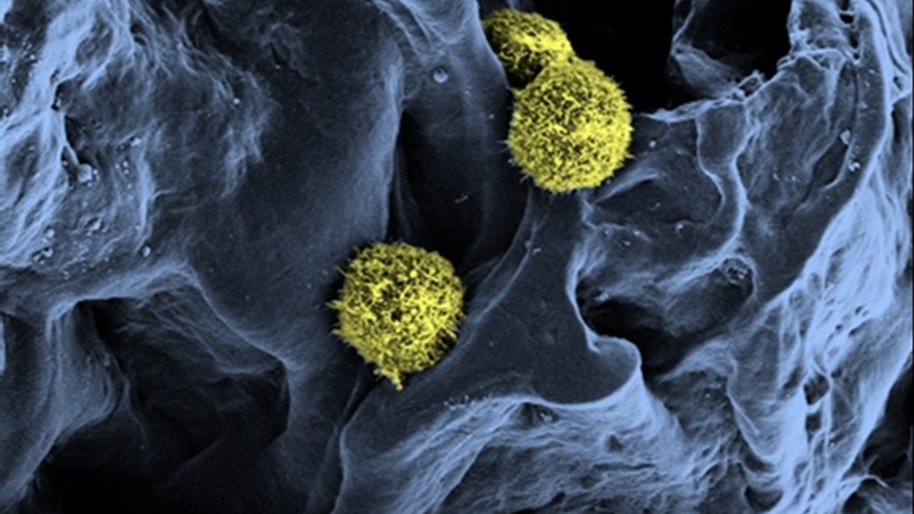 Scanning electron microscopy of stem cells (yellow / green) in a scaffold structure (blue) serving as a basis for the artificial bone marrow.