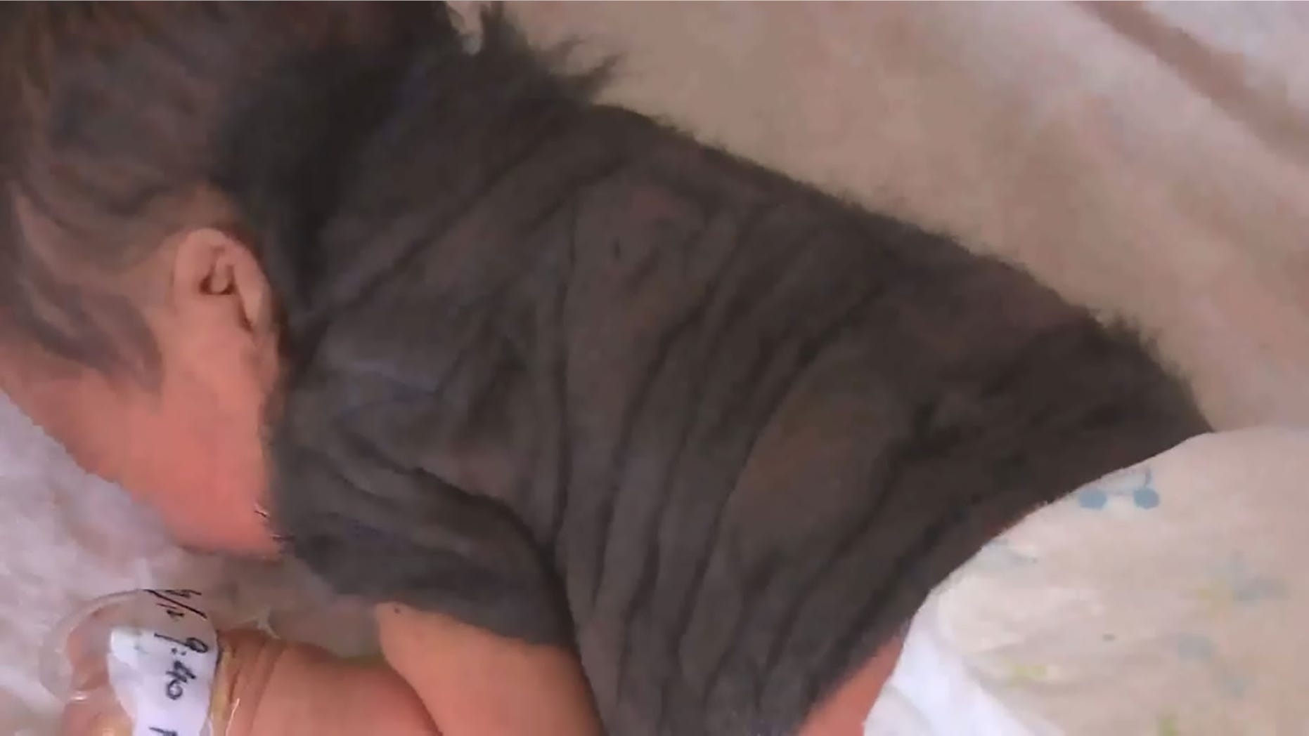 This photo shows the unidentified baby with the birthmark visible on his back.
