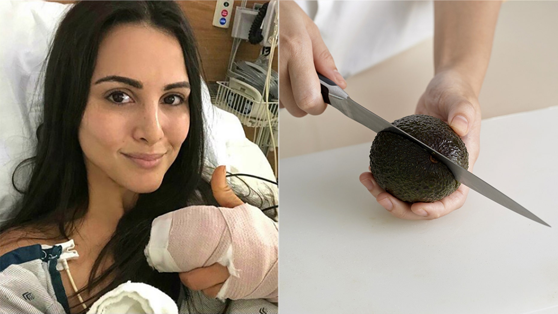 Former "Bachelorette" star Andi Dorfman says doctors needed to reattach tendons after she accidentally gave herself "avocado hand."