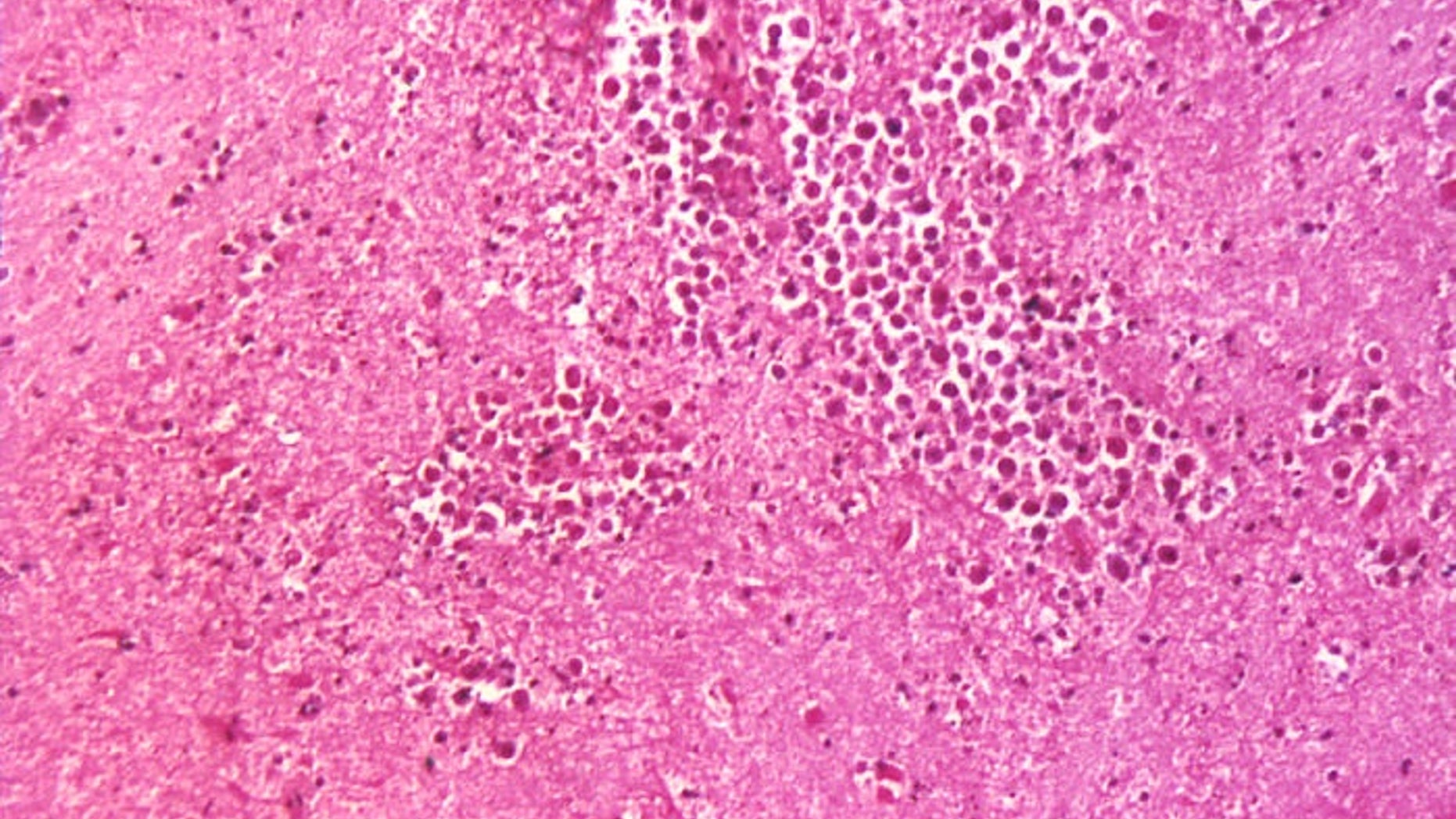 Traces of brain-eating amoeba, called Naegleria fowleri, was found in a parish in Louisiana.
