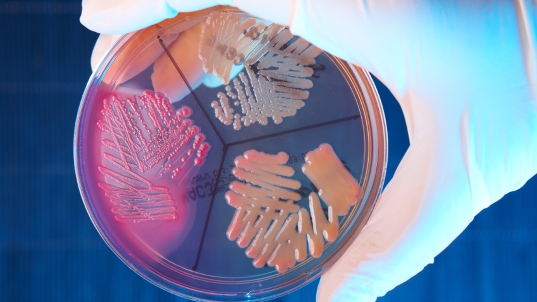Hand in glove holding Petri plate with bacteria Escherichia Coli, Klebisiella Pneumoniae, Serratia Marascens