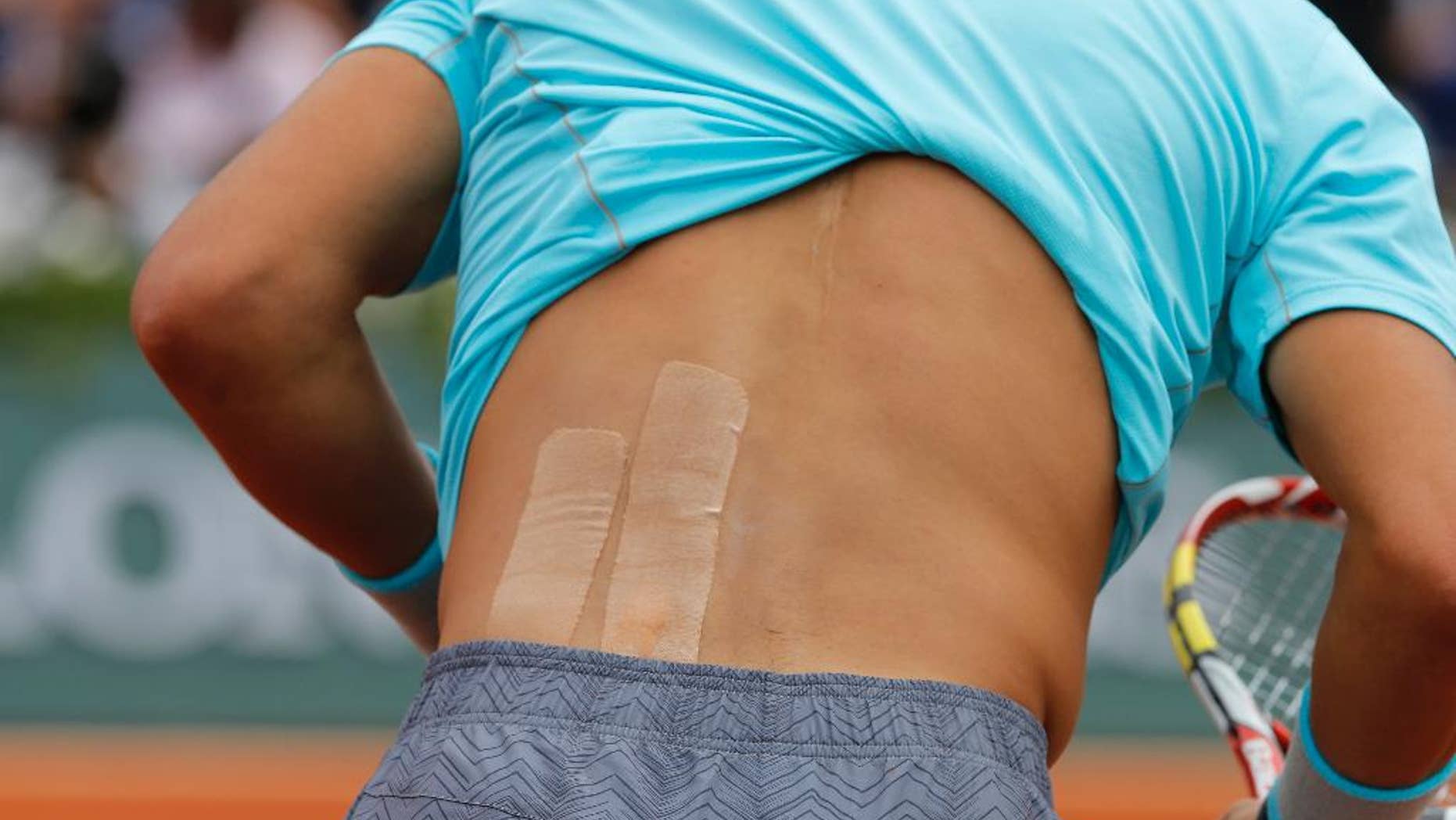 Strapping tape is seen on Spain's Rafael Nadal back during his fourth round match of the French Open tennis tournament against Serbia's Dusan Lajovic at the Roland Garros stadium, in Paris, France, Monday, June 2, 2014. Nadal won in three sets 6-1, 6-2, 6-1. (AP Photo/Michel Spingler)