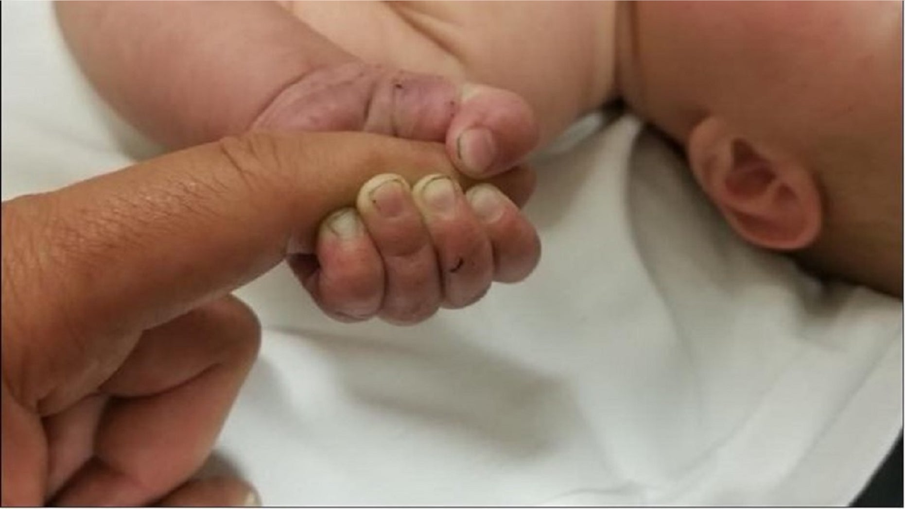 A 5-month-old baby was rescued early Sunday morning after surviving more than nine hours buried alive in the cold Montana wilderness, police said.