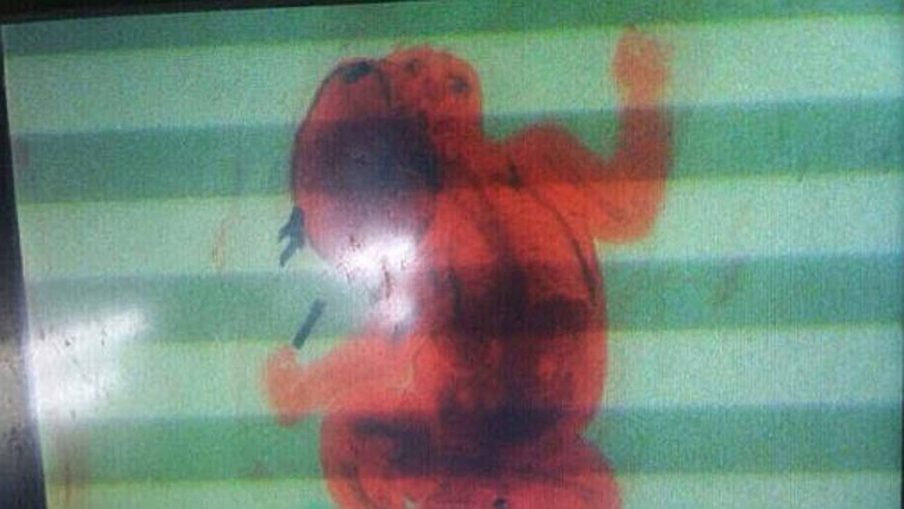 Image from security X-ray scanner at Ninoy Aquino International Airport in the Philippines shows 2-month-old infant. The baby's mother tried to smuggle her son in a backpack through security before officials stopped her.