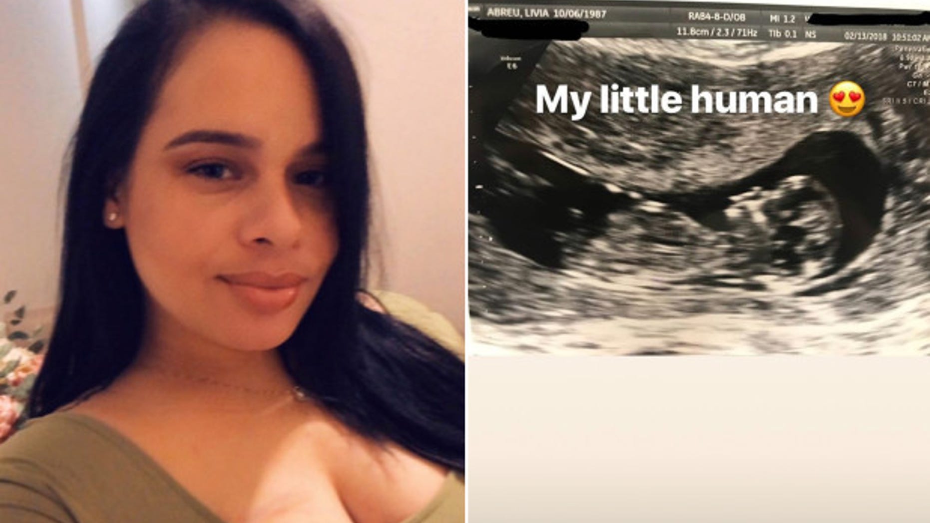 U.S. Army veteran Liv Abreu, 30, was stabbed multiple times, authorities said. Her baby, seen in a sonogram image, did not survive.
