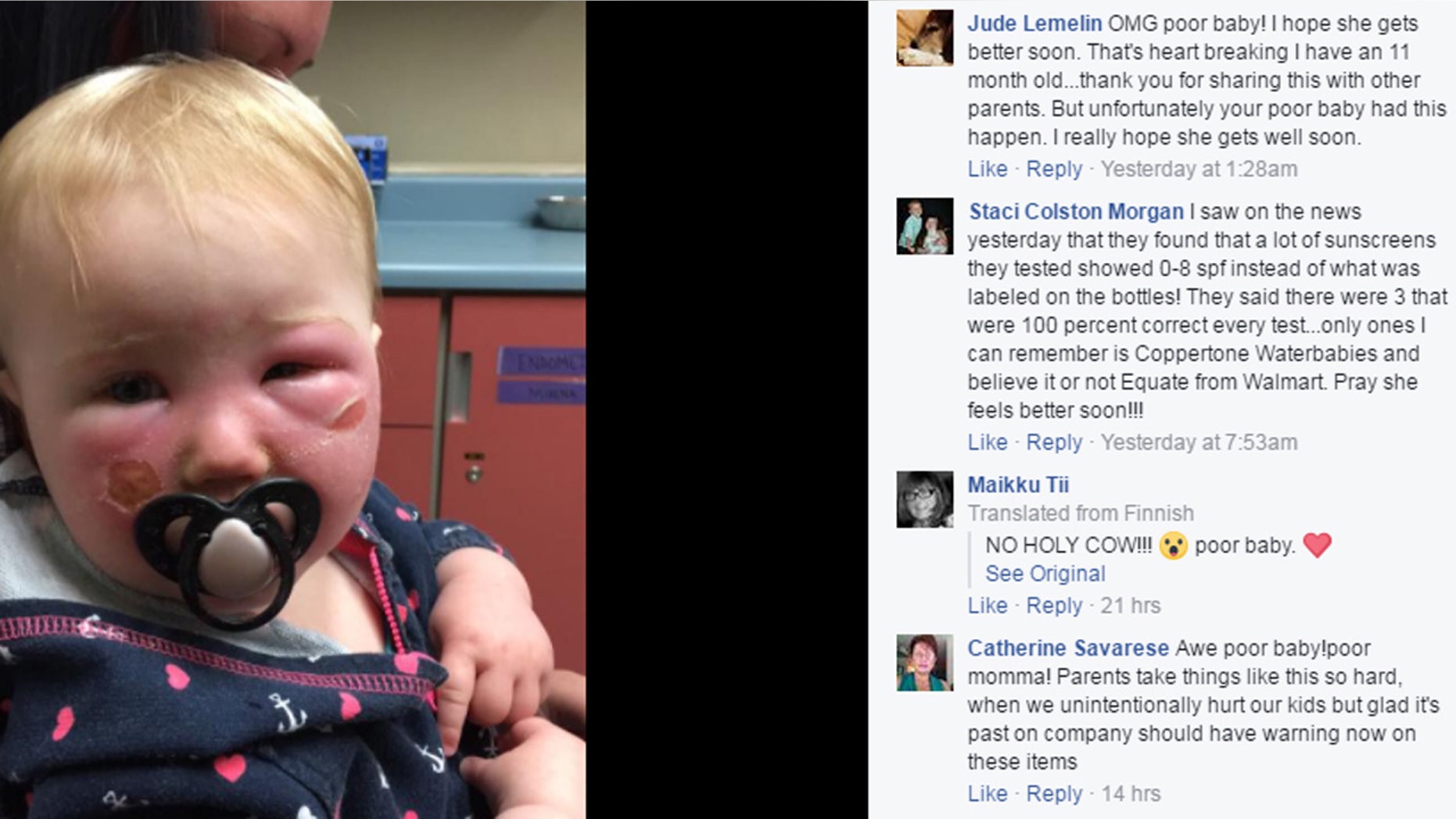 Rebecca Cannon said her daughter's face started blistering after she used Banana Boat Kids SPF 50.
