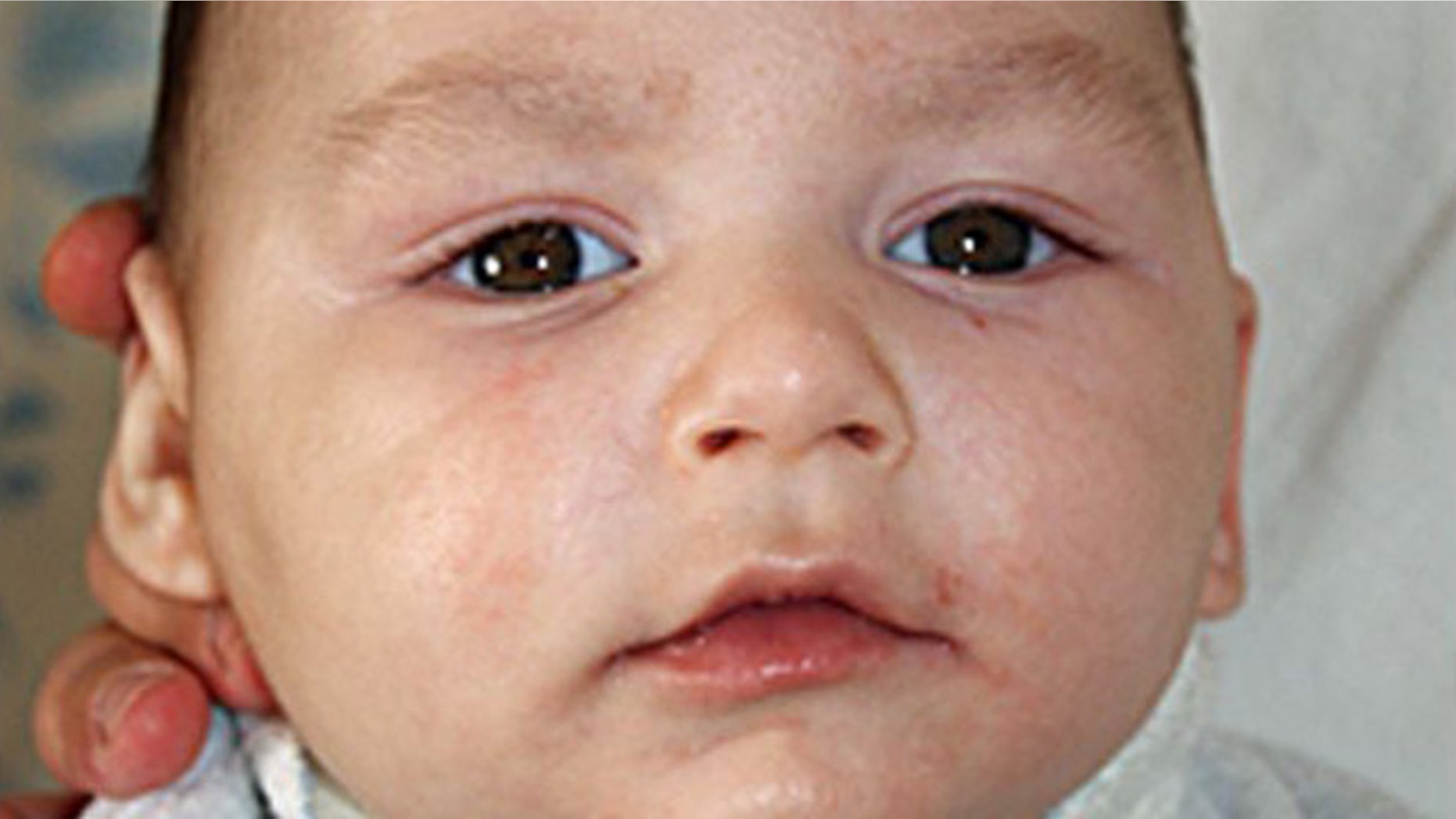 Baby Joseph Maraachli