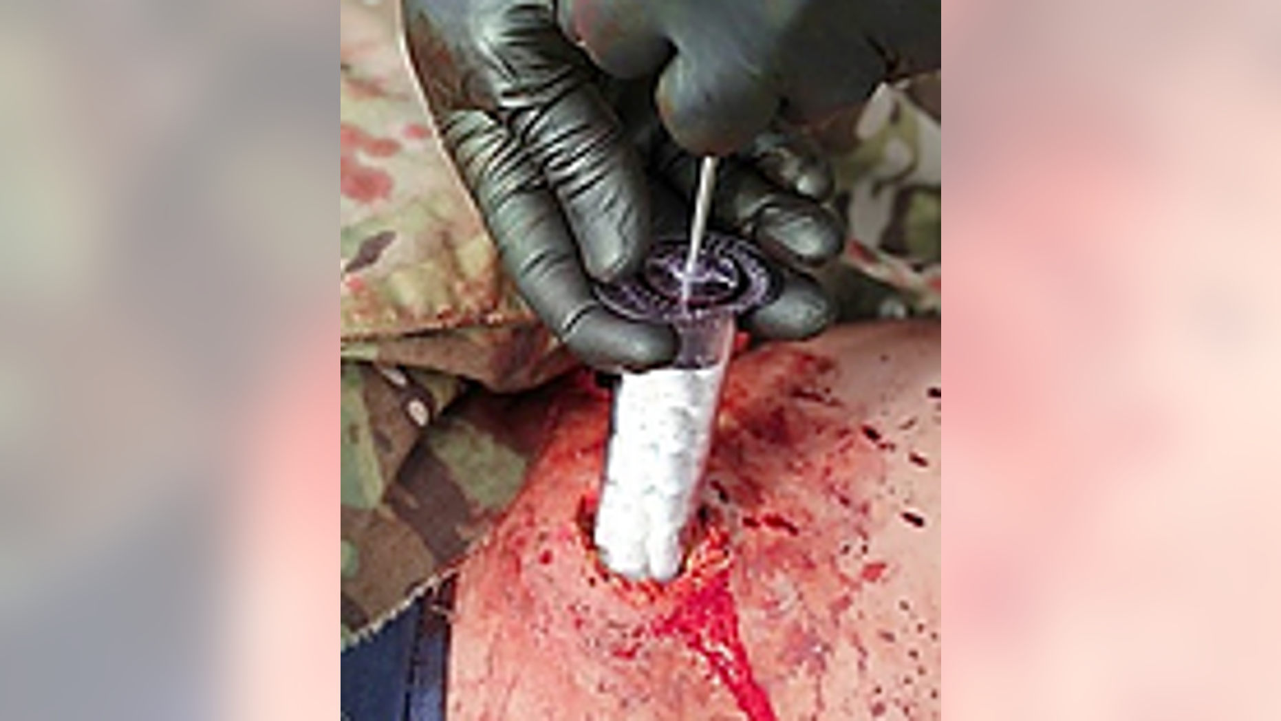 Simulation of XSTAT in action (RevMedx).