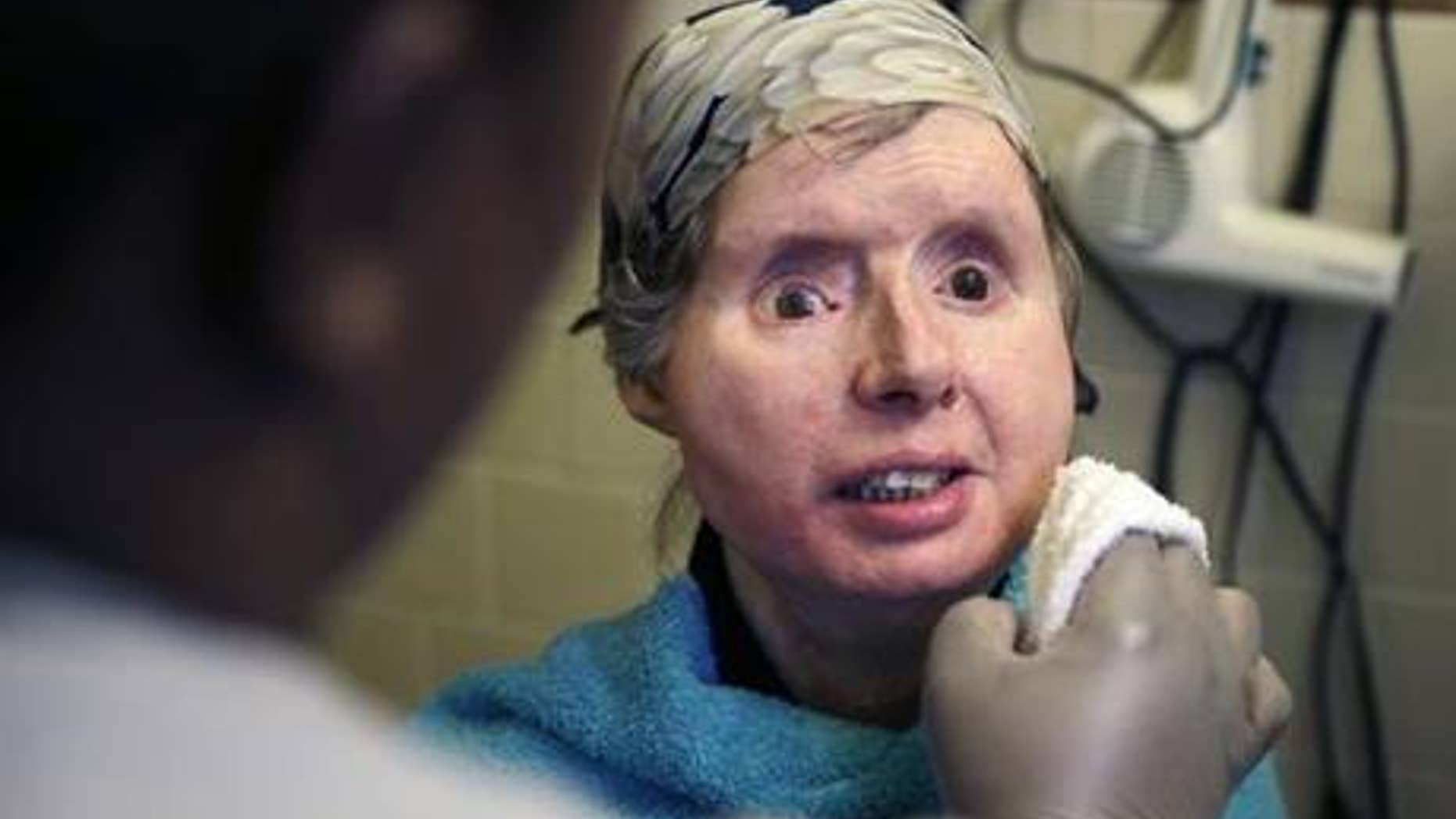 Feb. 20, 2015: In this file photo, Charla Nash smiles as her care worker washes her face at her apartment in Boston.