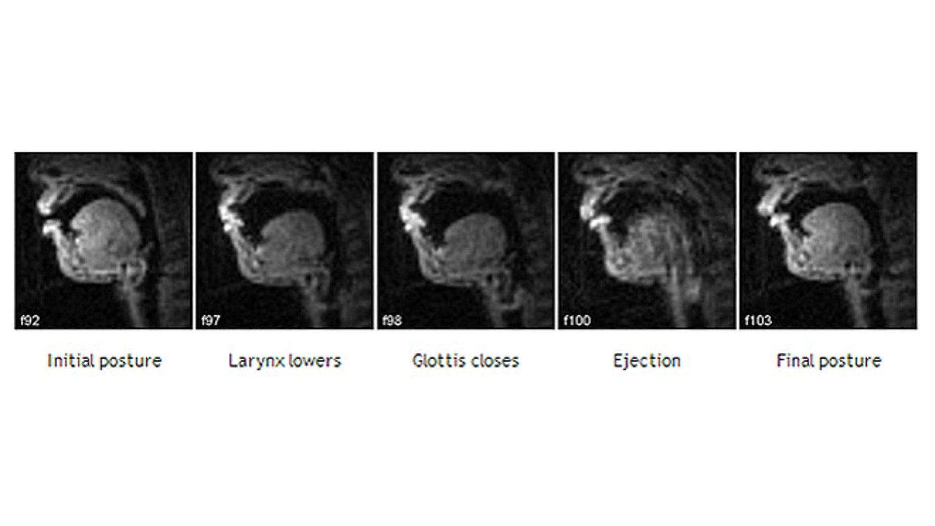 Many of the same mechanisms observed in human speech production were exploited for musical effect, including patterns of articulation that do not occur in the phonologies of the artist's native languages: ejectives, clicks and implosives.
