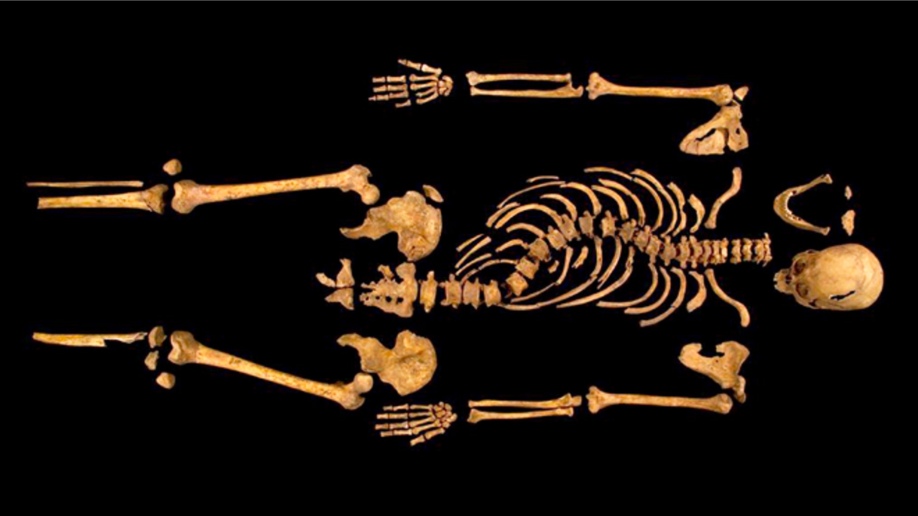 Feb. 4 2013: The curved spine and other long lost remains of England's King Richard III, missing for 500 years. Richard was immortalized in a play by Shakespeare as a hunchbacked usurper who left a trail of bodies including those of his two young nephews, murdered in the Tower of London on his way to the throne.