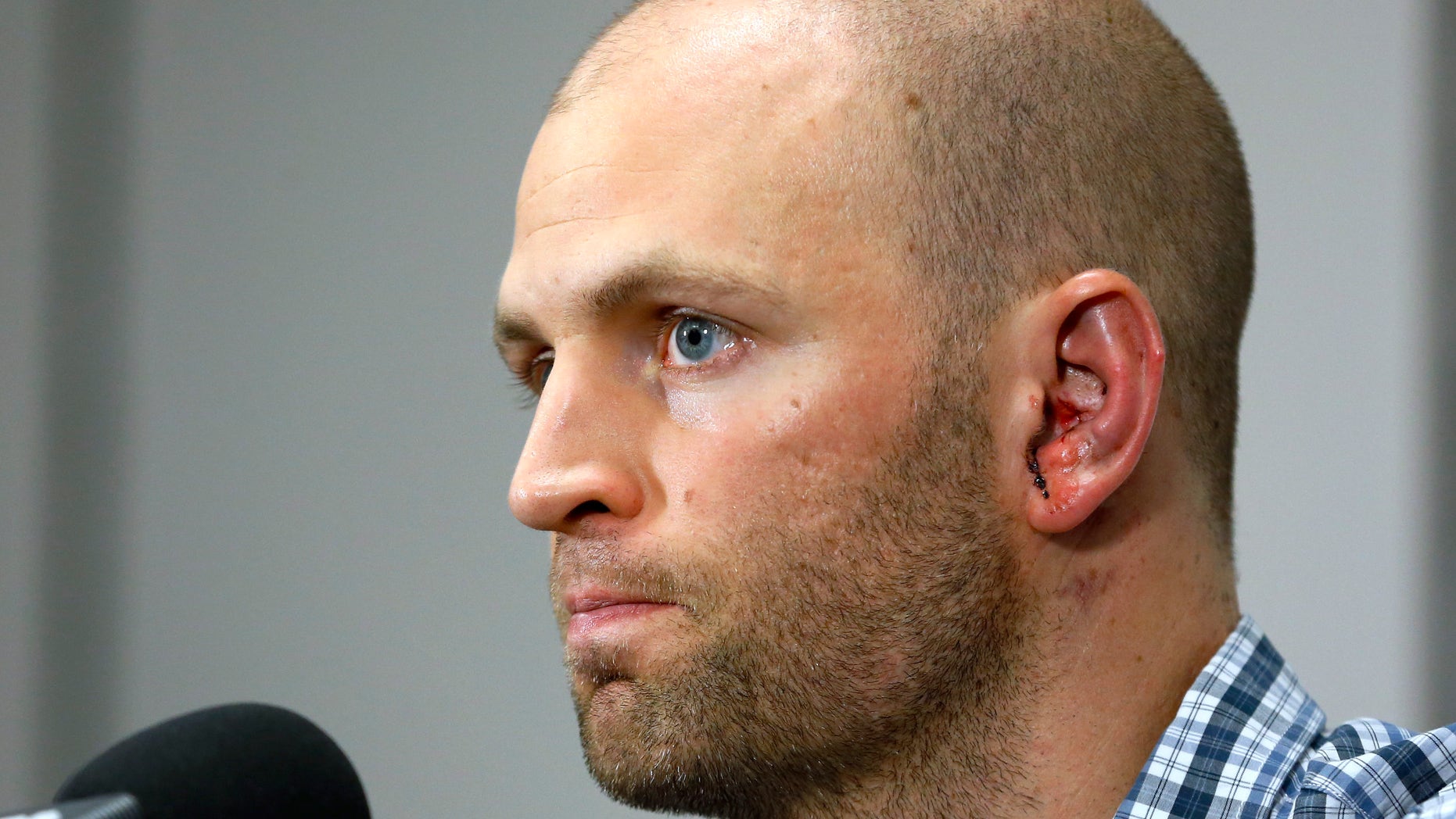 Toronto Blue Jays pitcher J.A. Happ attends a news conference prior to the Blue Jays' baseball game against the Tampa Bay Rays, Wednesday, May 8, 2013, in St. Petersburg, Fla. Happ was released Wednesday from a hospital, the day after he was hit on the head hit by a line drive from Tampa Bay Rays' Desmond Jennings. (AP Photo/Mike Carlson)